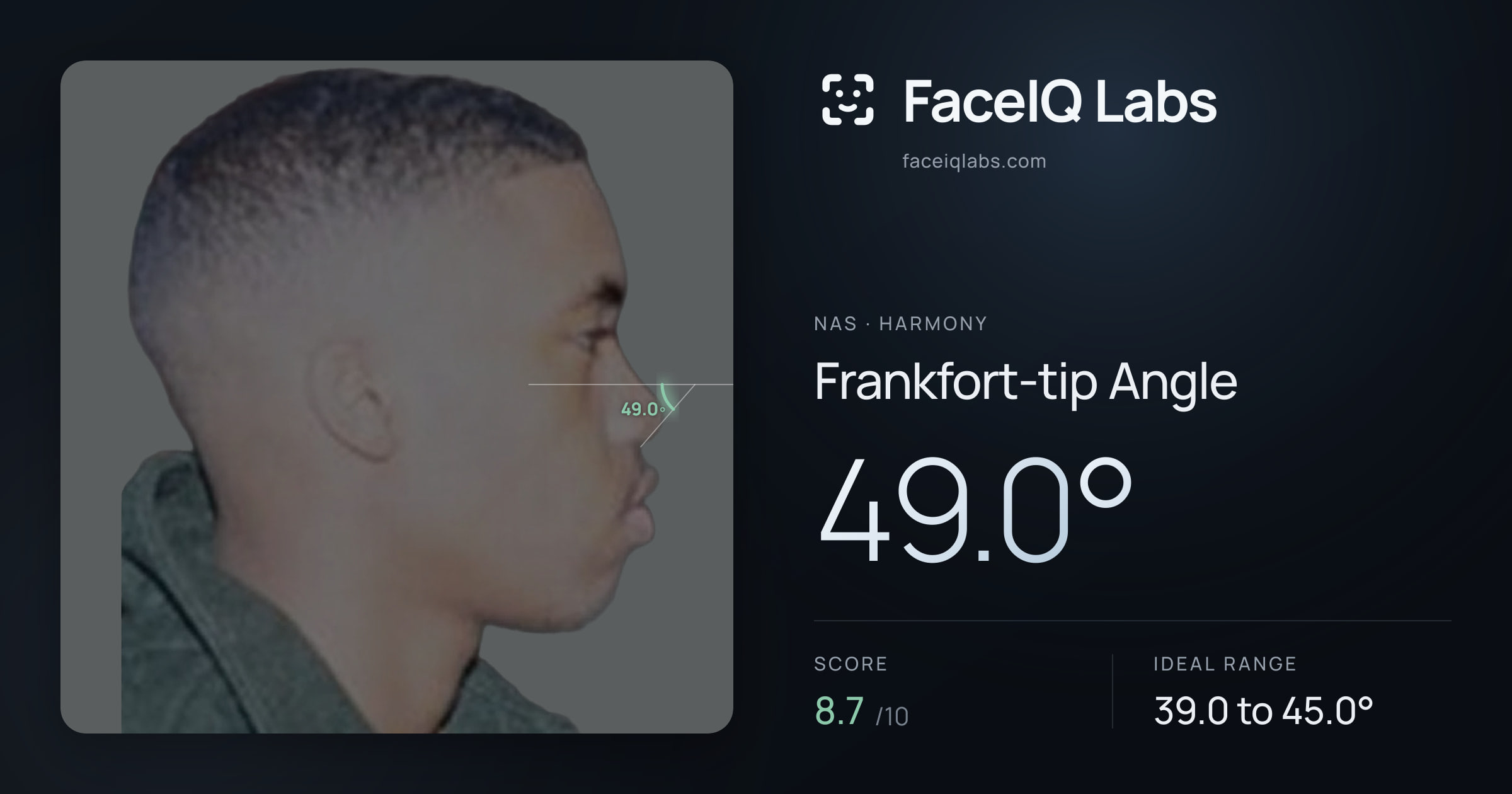 Nas Frankfort-tip Angle: 49.0°, drawn on the photo