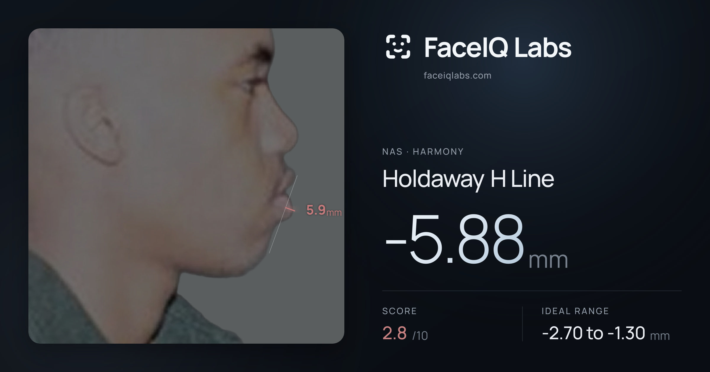 Nas Holdaway H Line: -5.88mm, drawn on the photo
