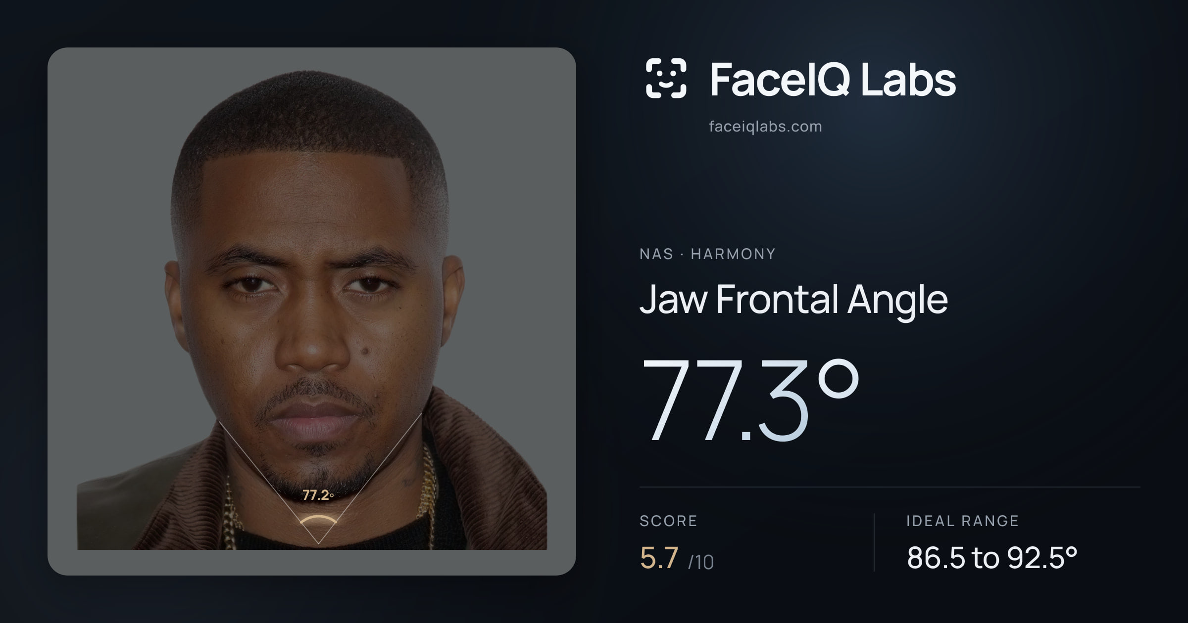 Nas Jaw Frontal Angle: 77.3°, drawn on the photo