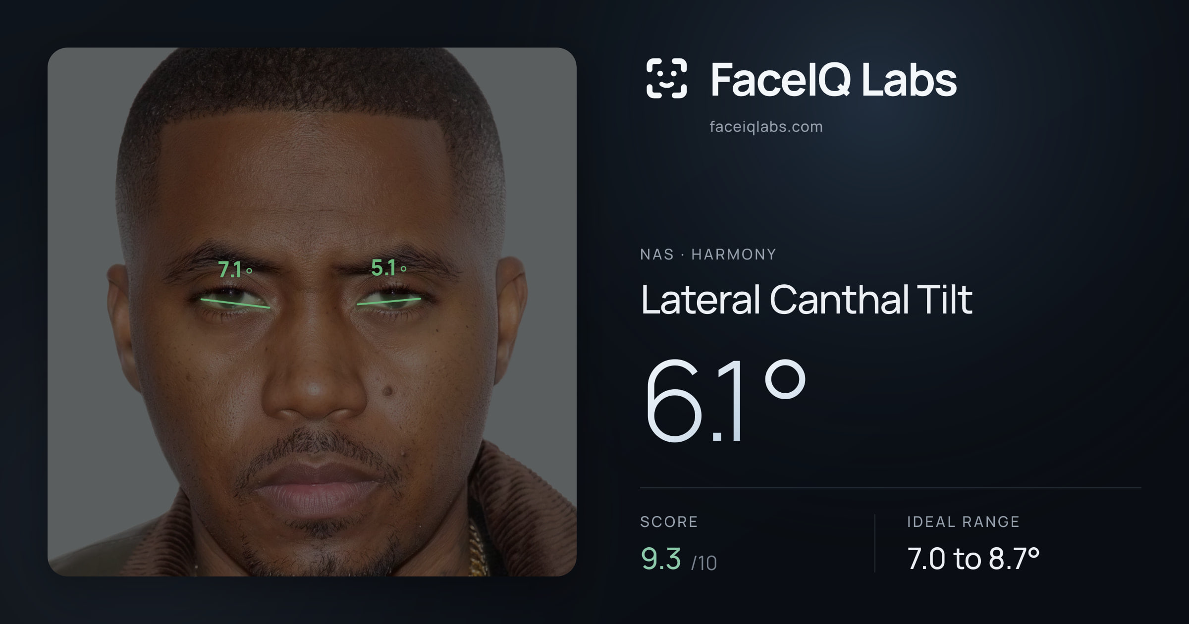 Nas Lateral Canthal Tilt: 6.1°, drawn on the photo