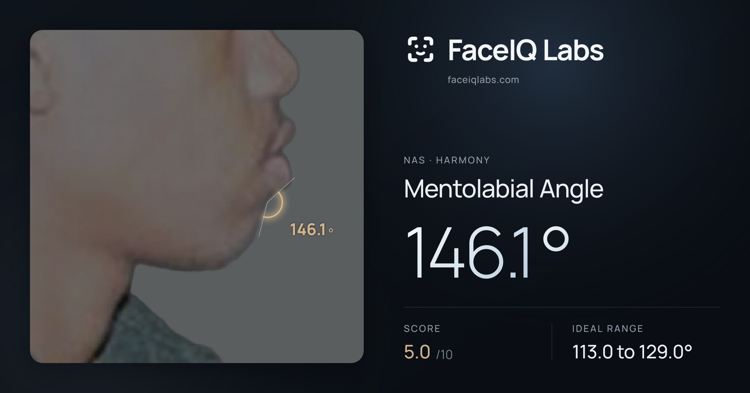 Nas Mentolabial Angle: 146.1°, drawn on the photo