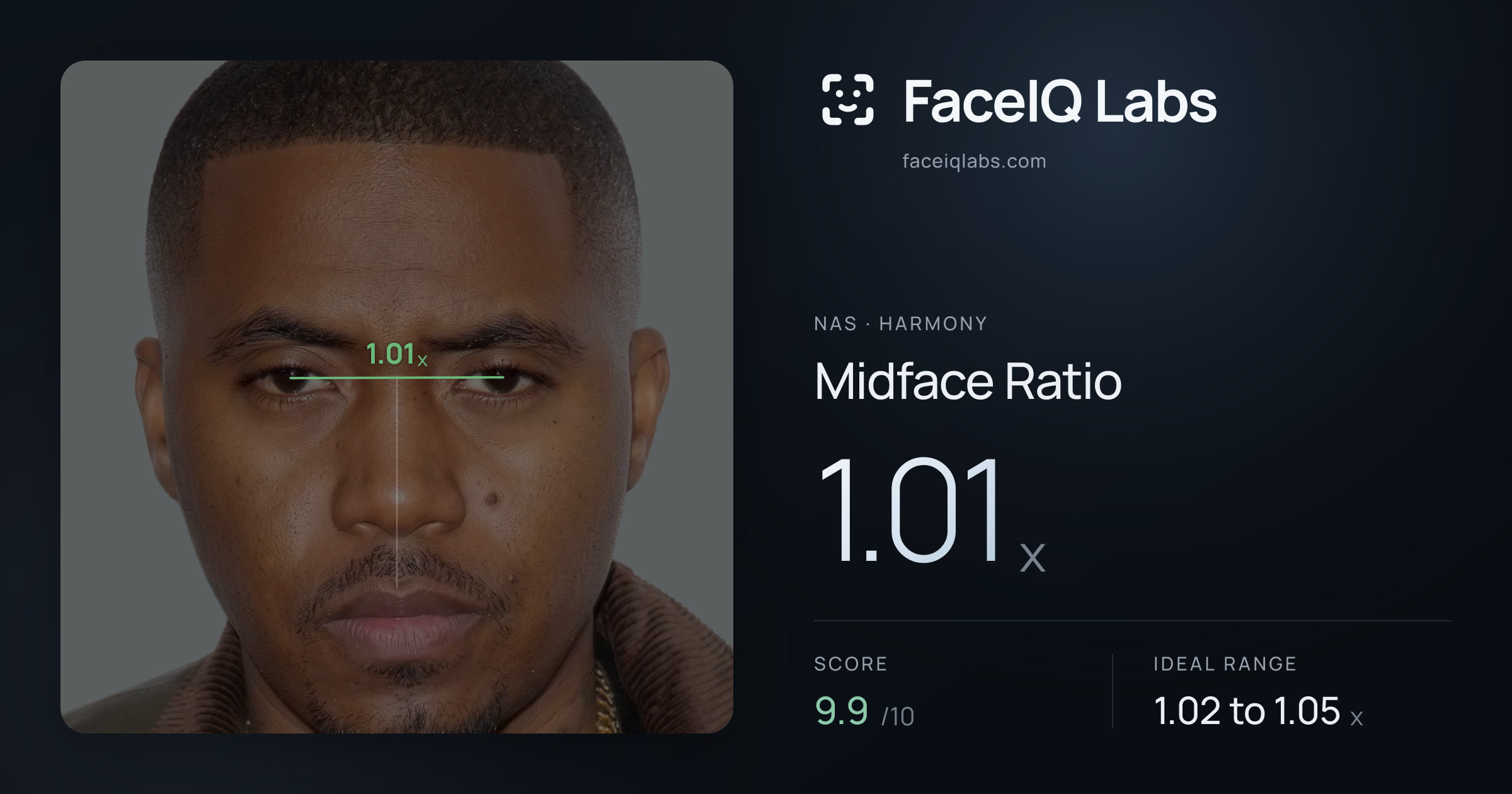 Nas Midface Ratio: 1.01x, drawn on the photo