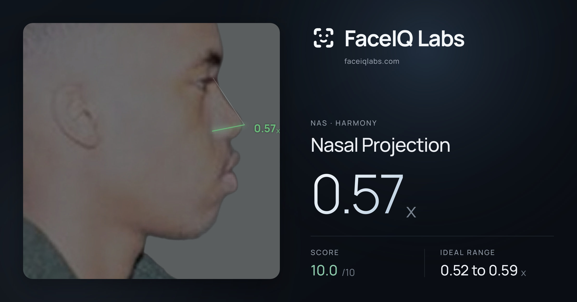 Nas Nasal Projection: 0.57x, drawn on the photo