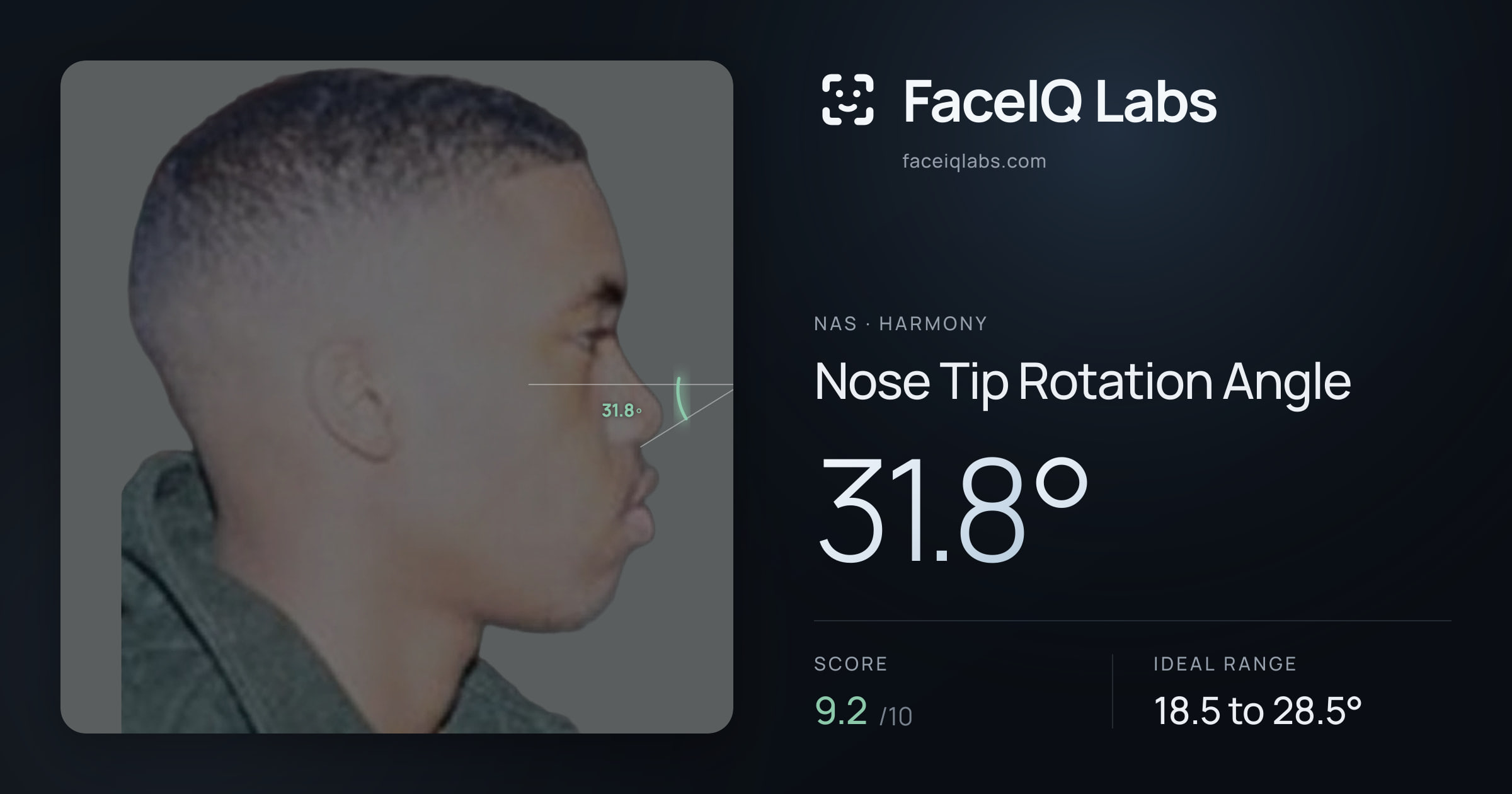 Nas Nose Tip Rotation Angle: 31.8°, drawn on the photo