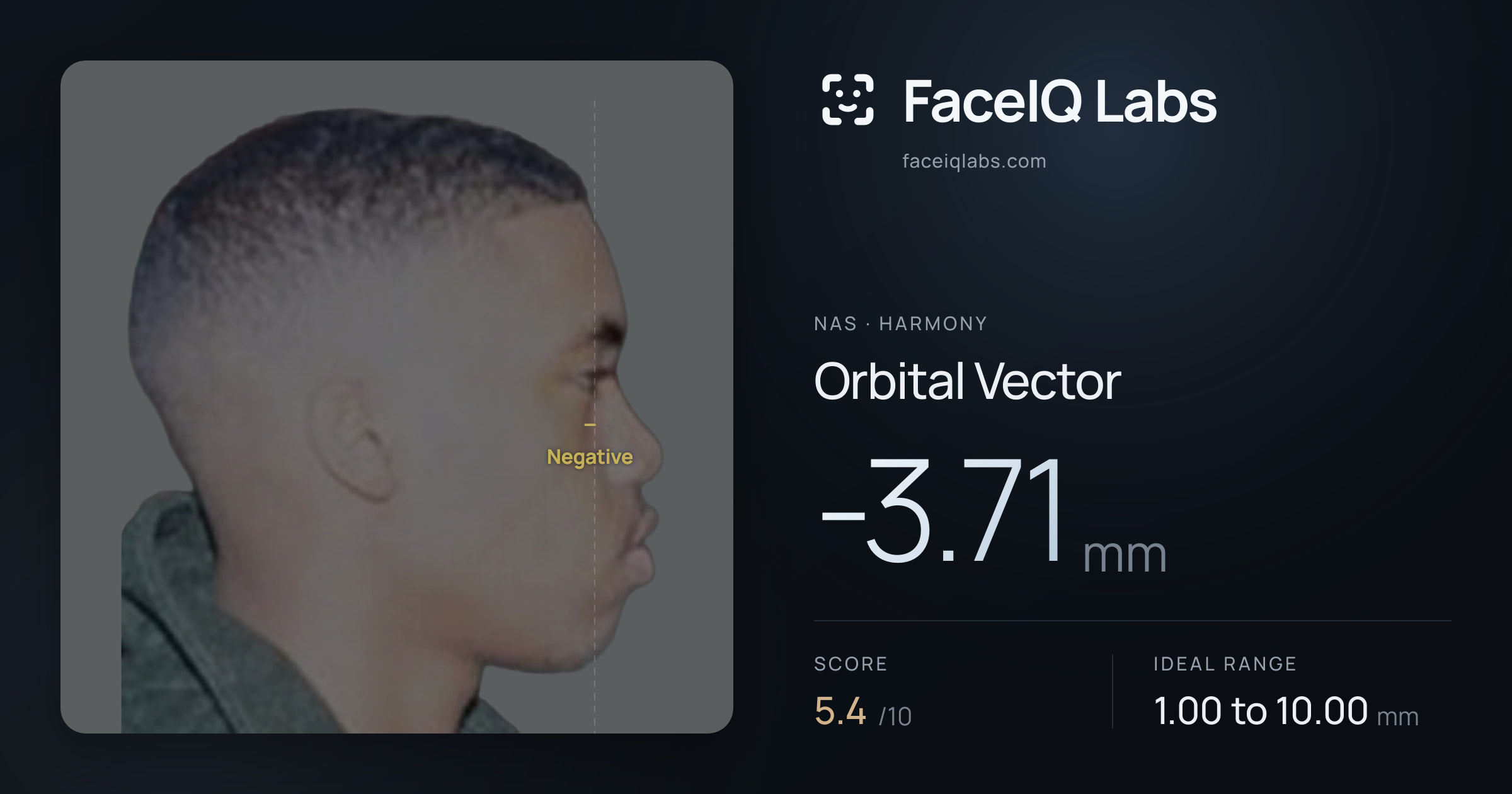 Nas Orbital Vector: -3.71mm, drawn on the photo