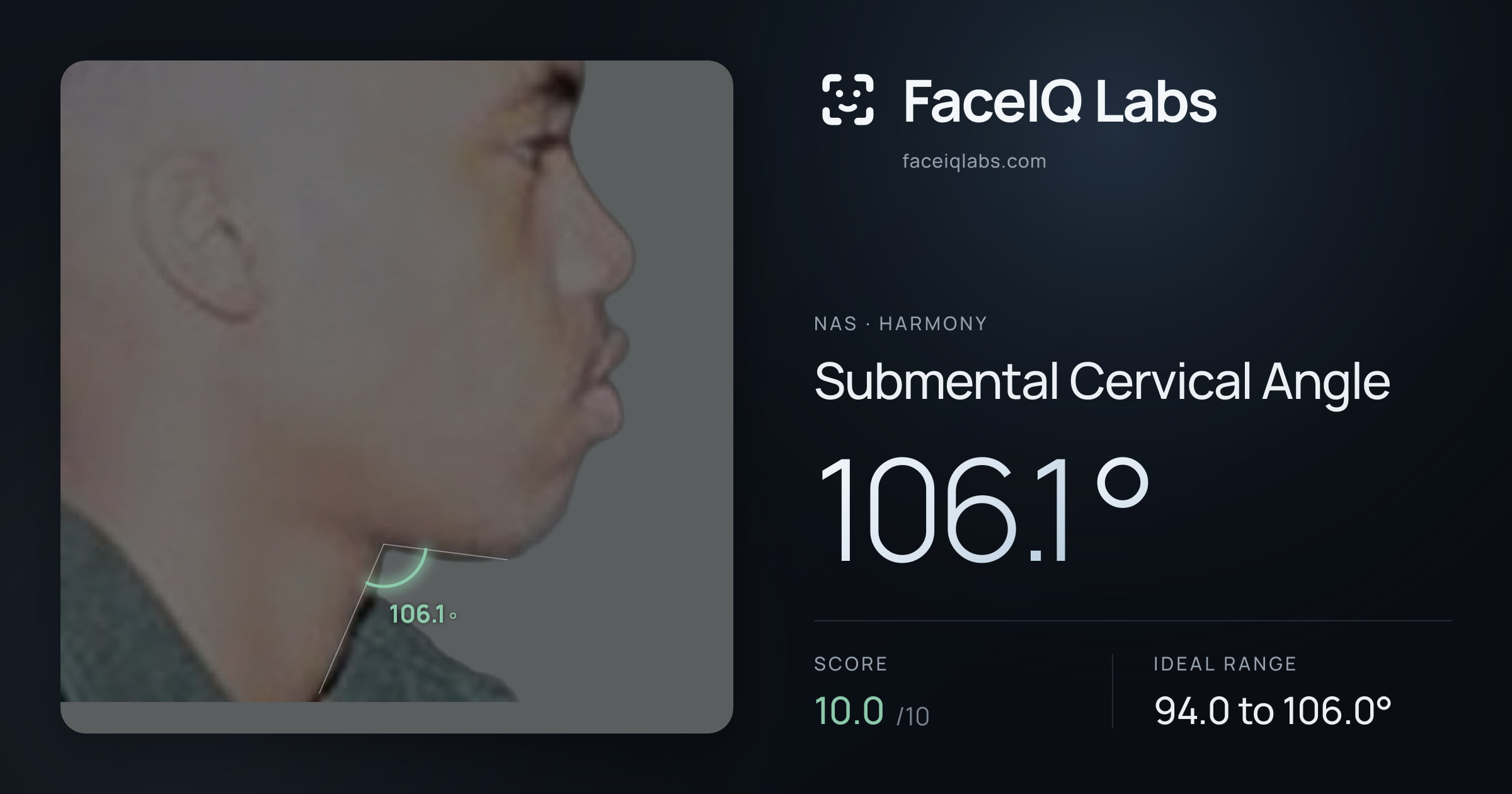 Nas Submental Cervical Angle: 106.1°, drawn on the photo