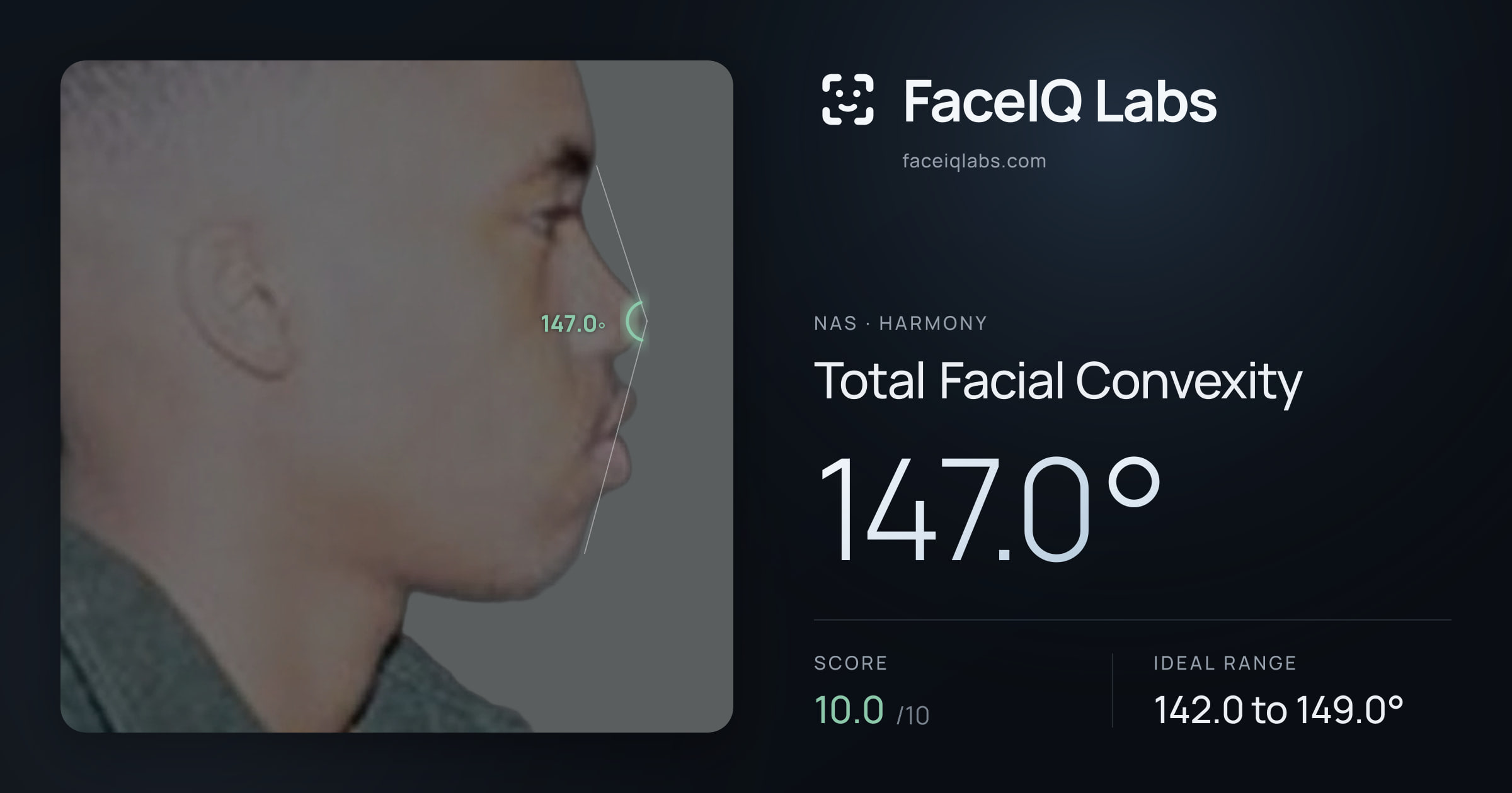 Nas Total Facial Convexity: 147.0°, drawn on the photo