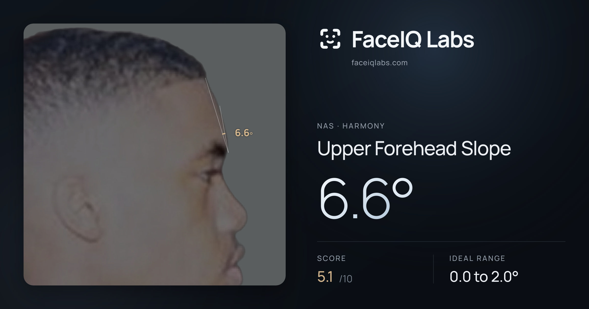 Nas Upper Forehead Slope: 6.6°, drawn on the photo