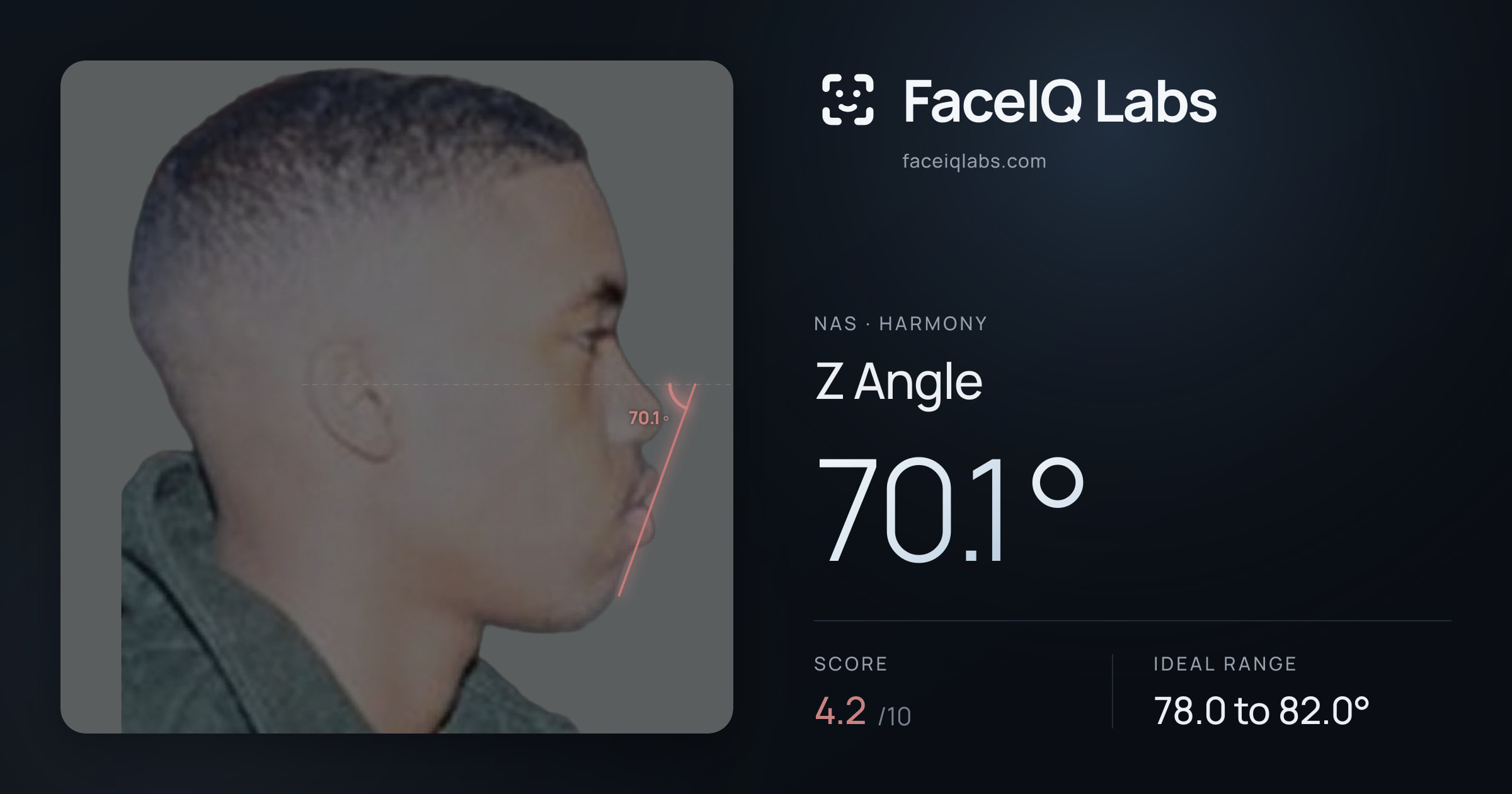 Nas Z Angle: 70.1°, drawn on the photo