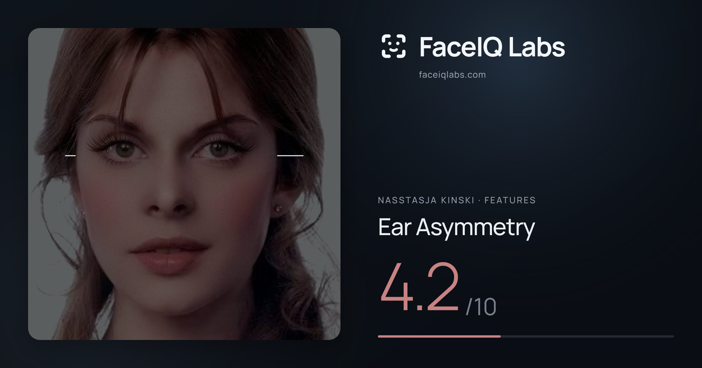 Nasstasja Kinski Ear Asymmetry: 4.2/10, drawn on the photo