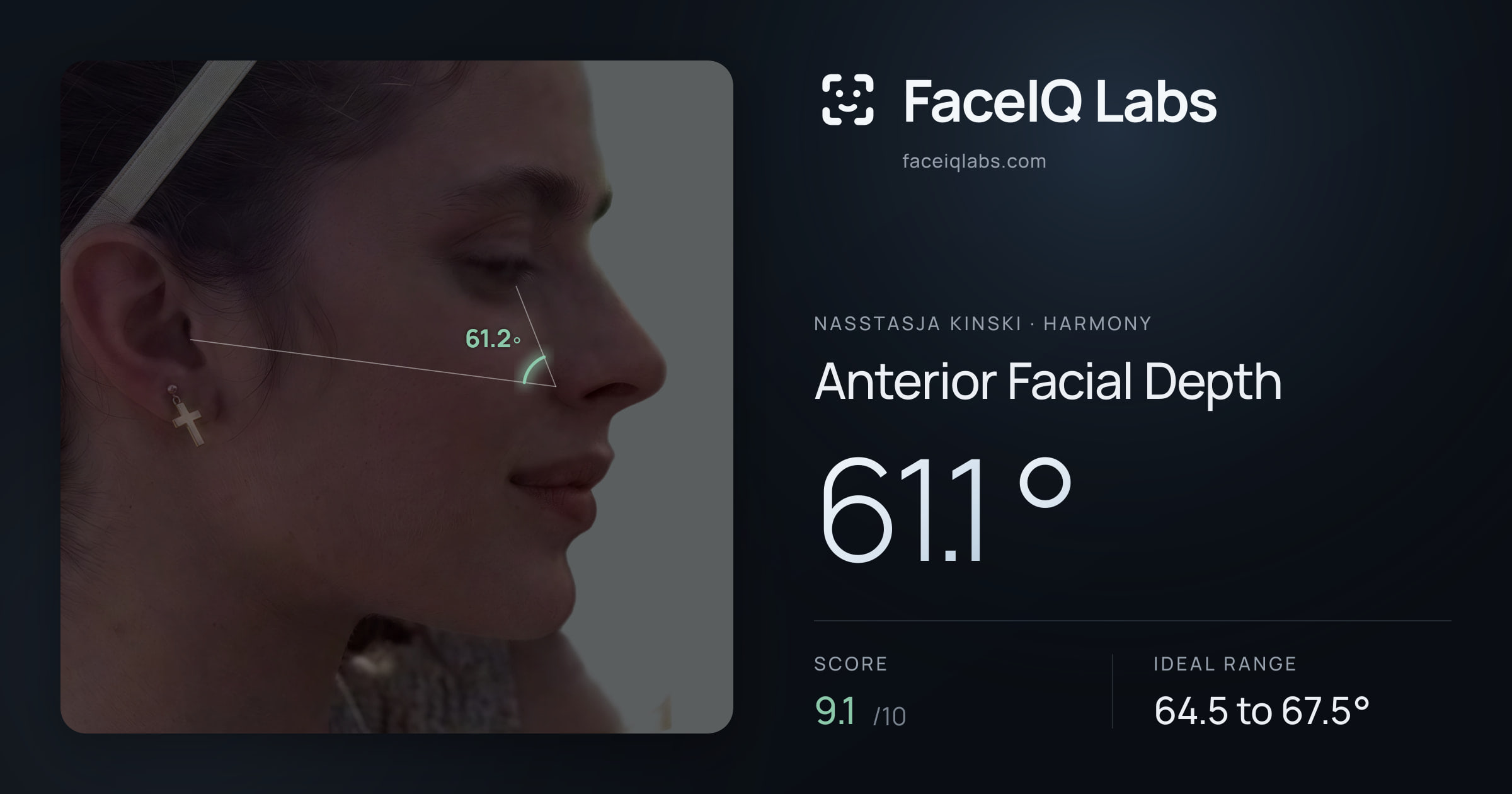 Nasstasja Kinski Anterior Facial Depth: 61.1°, drawn on the photo