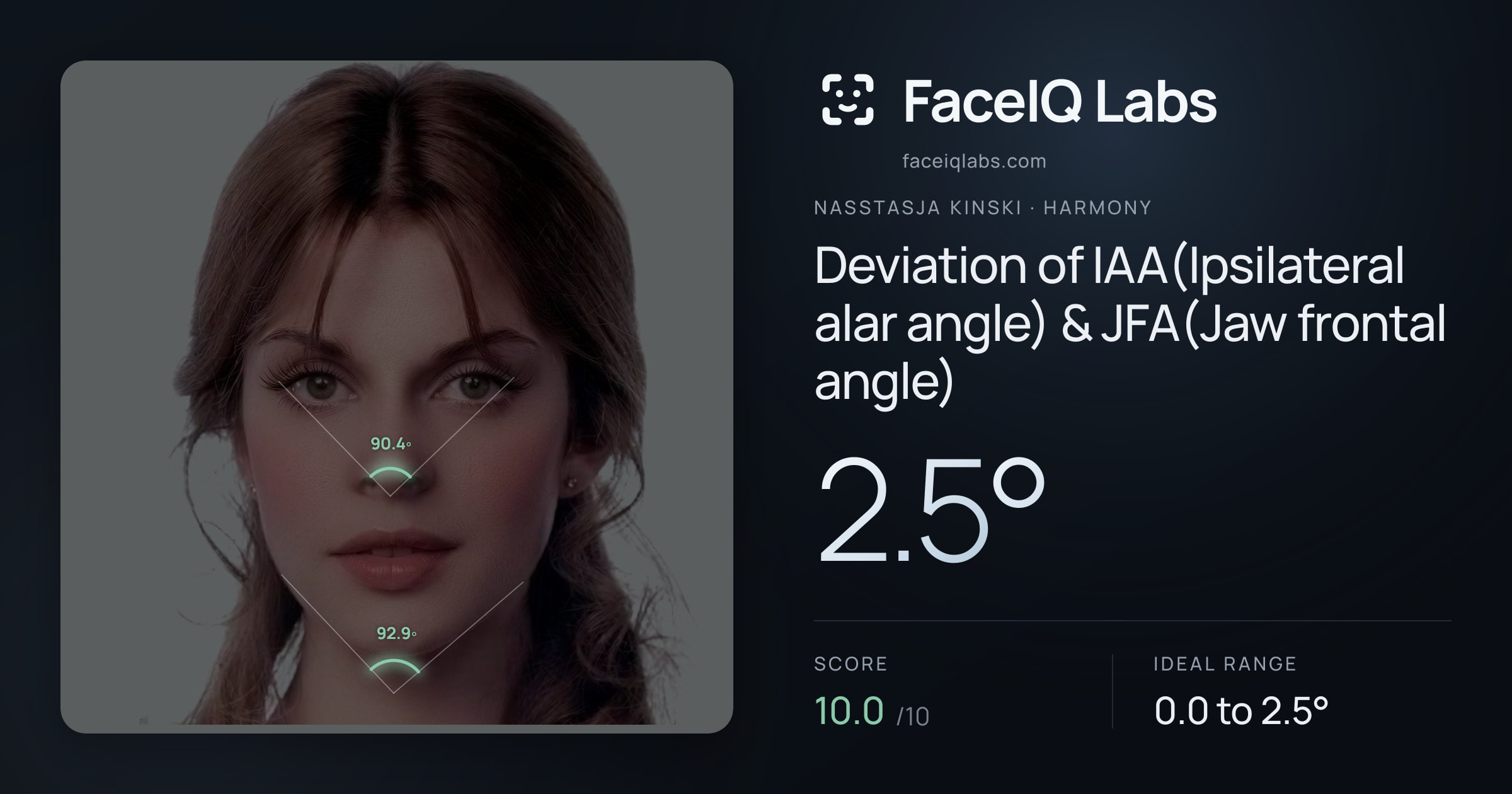 Nasstasja Kinski Deviation of IAA(Ipsilateral alar angle) & JFA(Jaw frontal angle): 2.5°, drawn on the photo