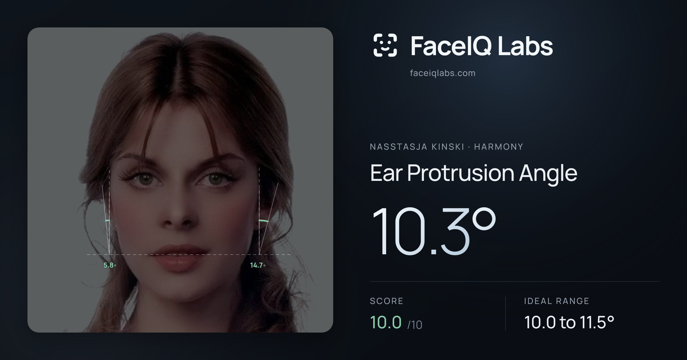 Nasstasja Kinski Ear Protrusion Angle: 10.3°, drawn on the photo