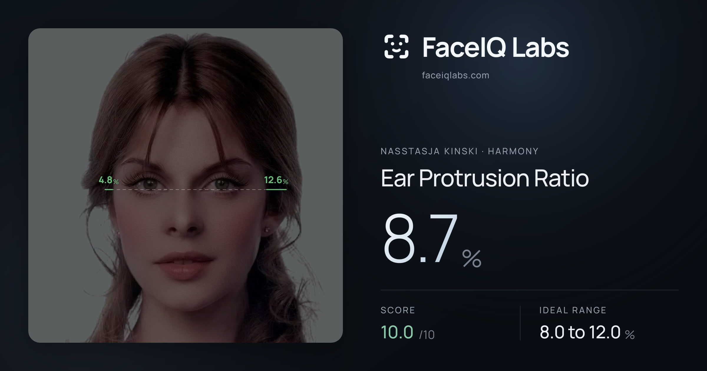 Nasstasja Kinski Ear Protrusion Ratio: 8.7%, drawn on the photo