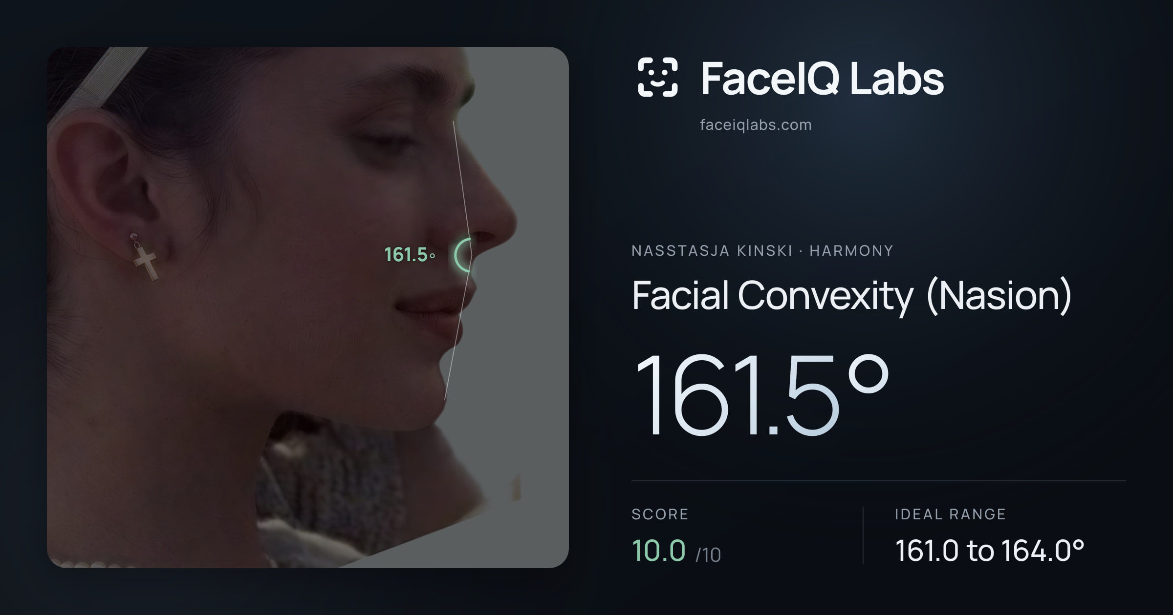 Nasstasja Kinski Facial Convexity (Nasion): 161.5°, drawn on the photo