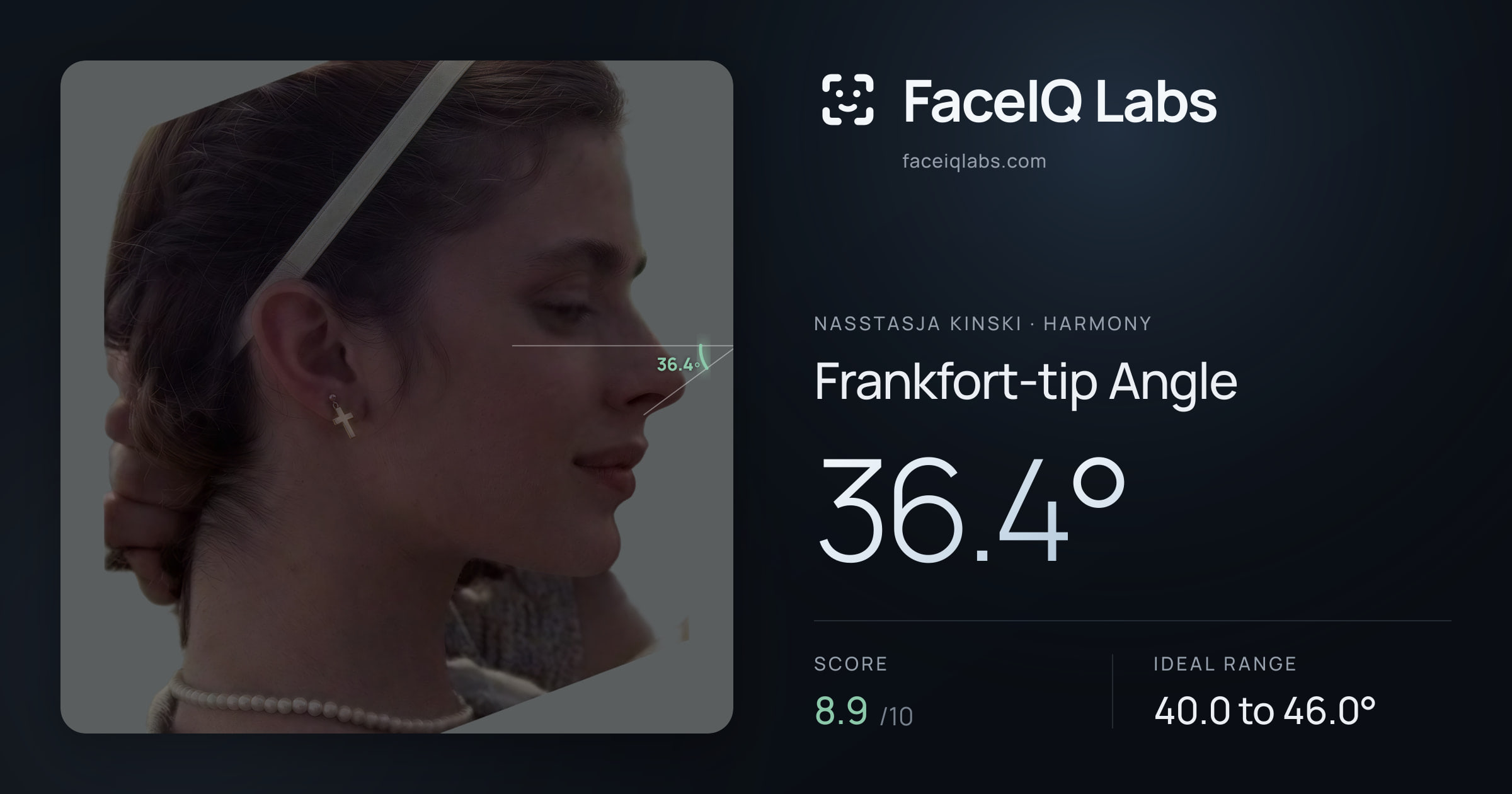 Nasstasja Kinski Frankfort-tip Angle: 36.4°, drawn on the photo