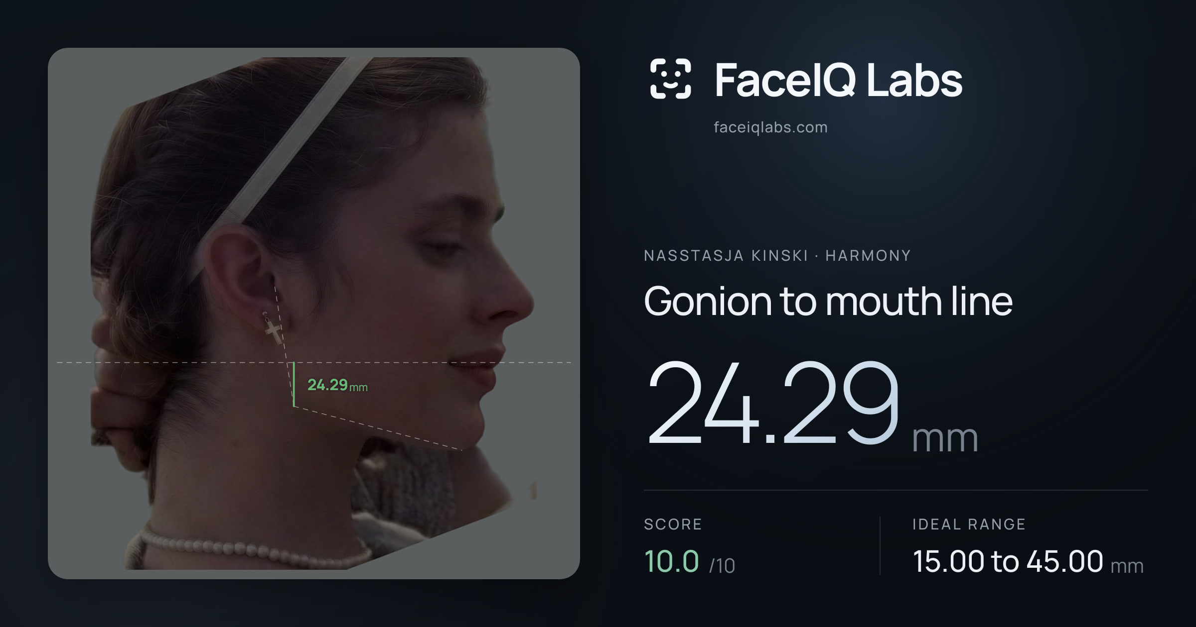 Nasstasja Kinski Gonion to mouth line: 24.29mm, drawn on the photo