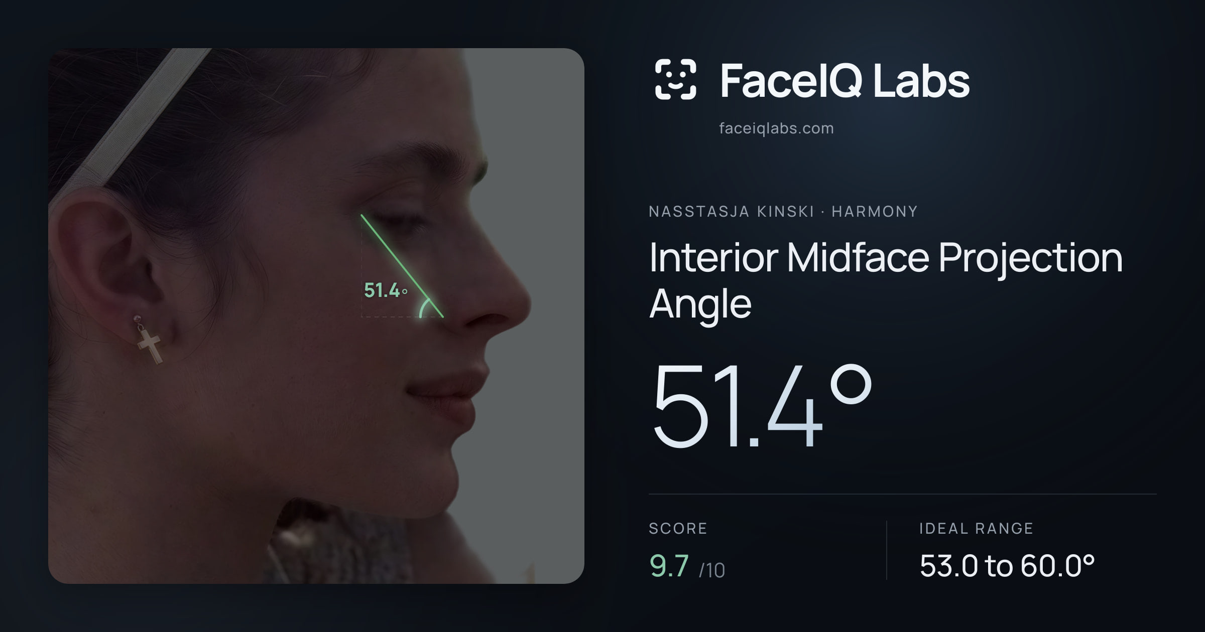 Nasstasja Kinski Interior Midface Projection Angle: 51.4°, drawn on the photo