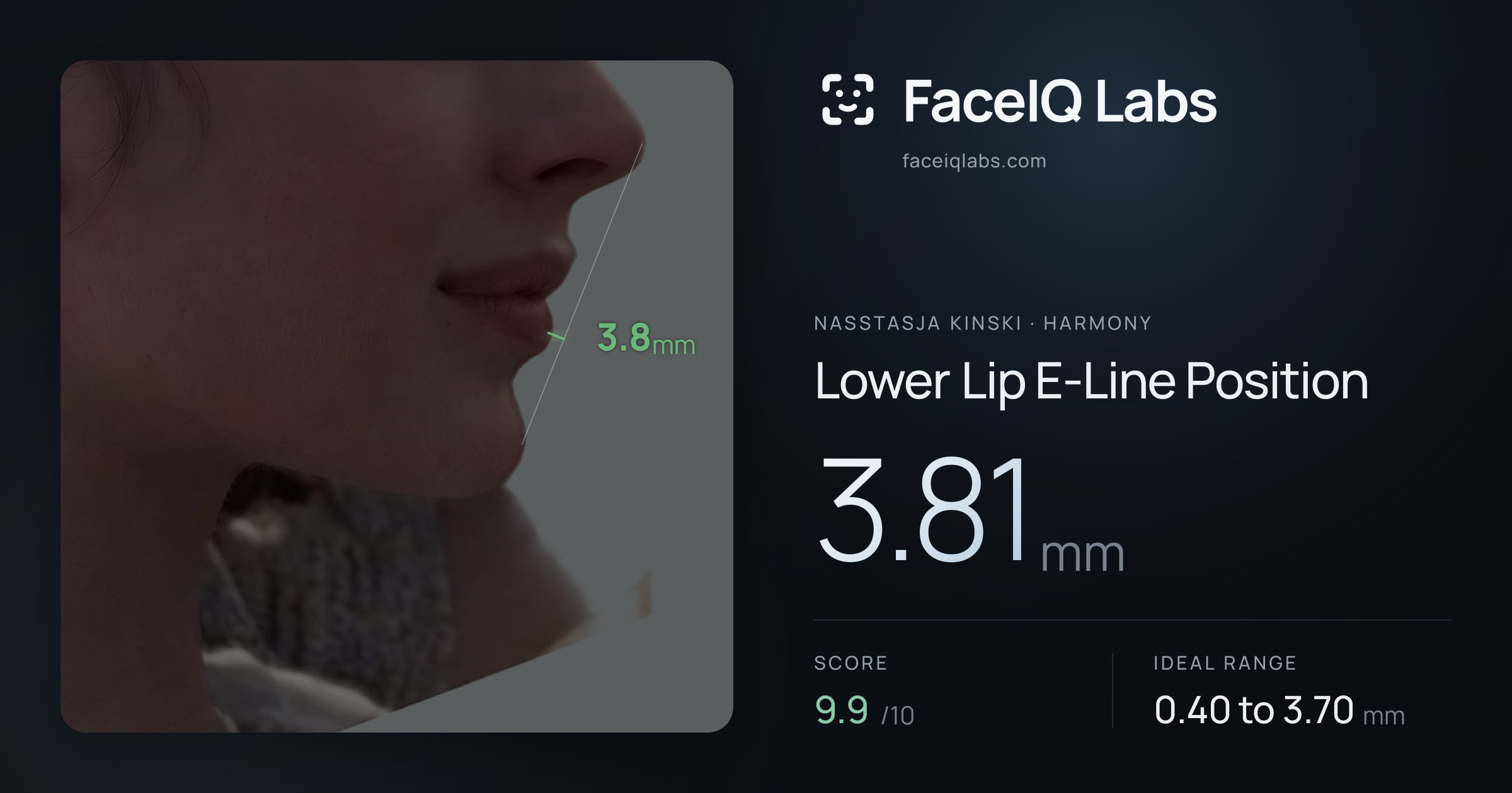 Nasstasja Kinski Lower Lip E-Line Position: 3.81mm, drawn on the photo