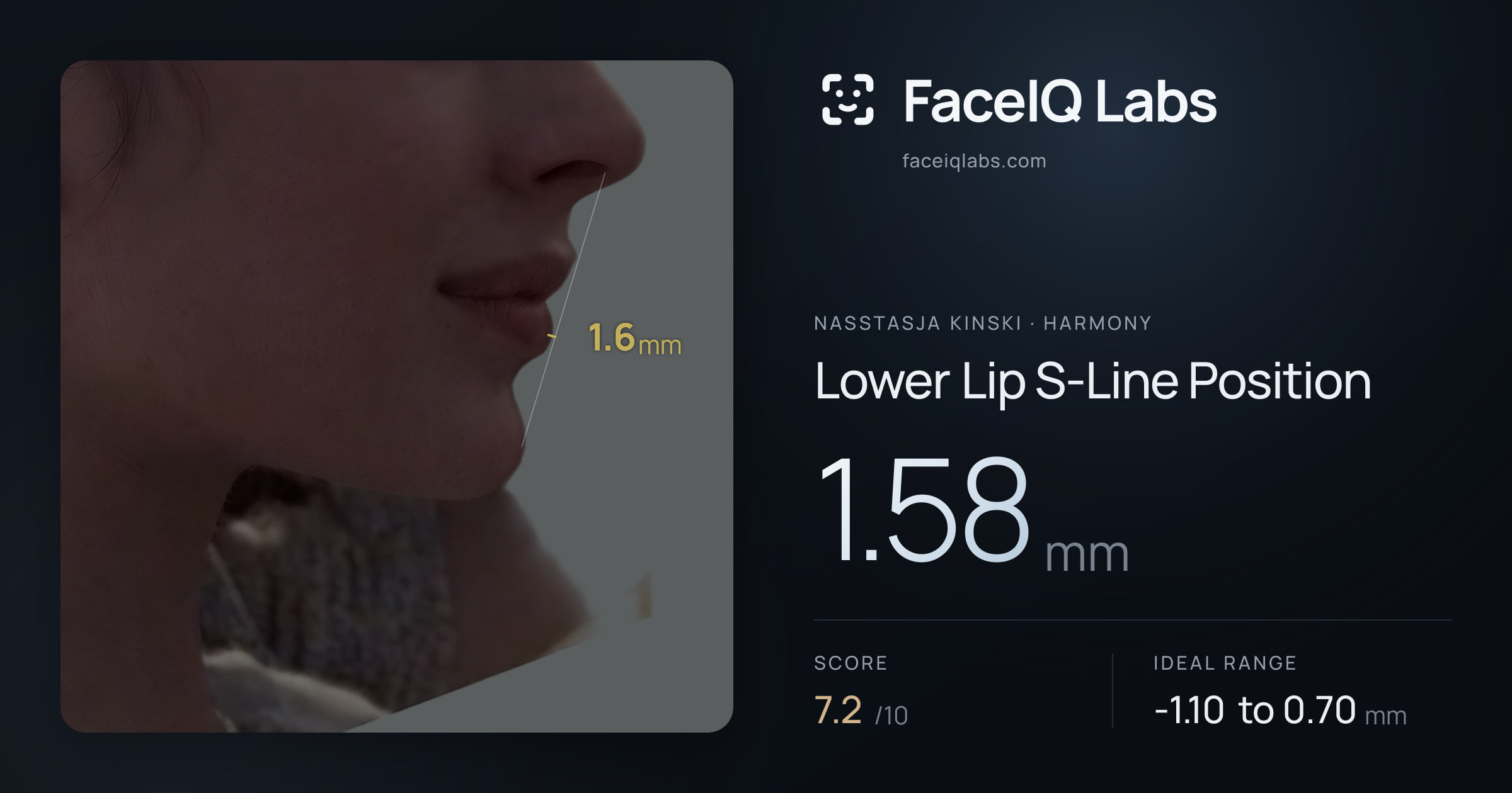 Nasstasja Kinski Lower Lip S-Line Position: 1.58mm, drawn on the photo
