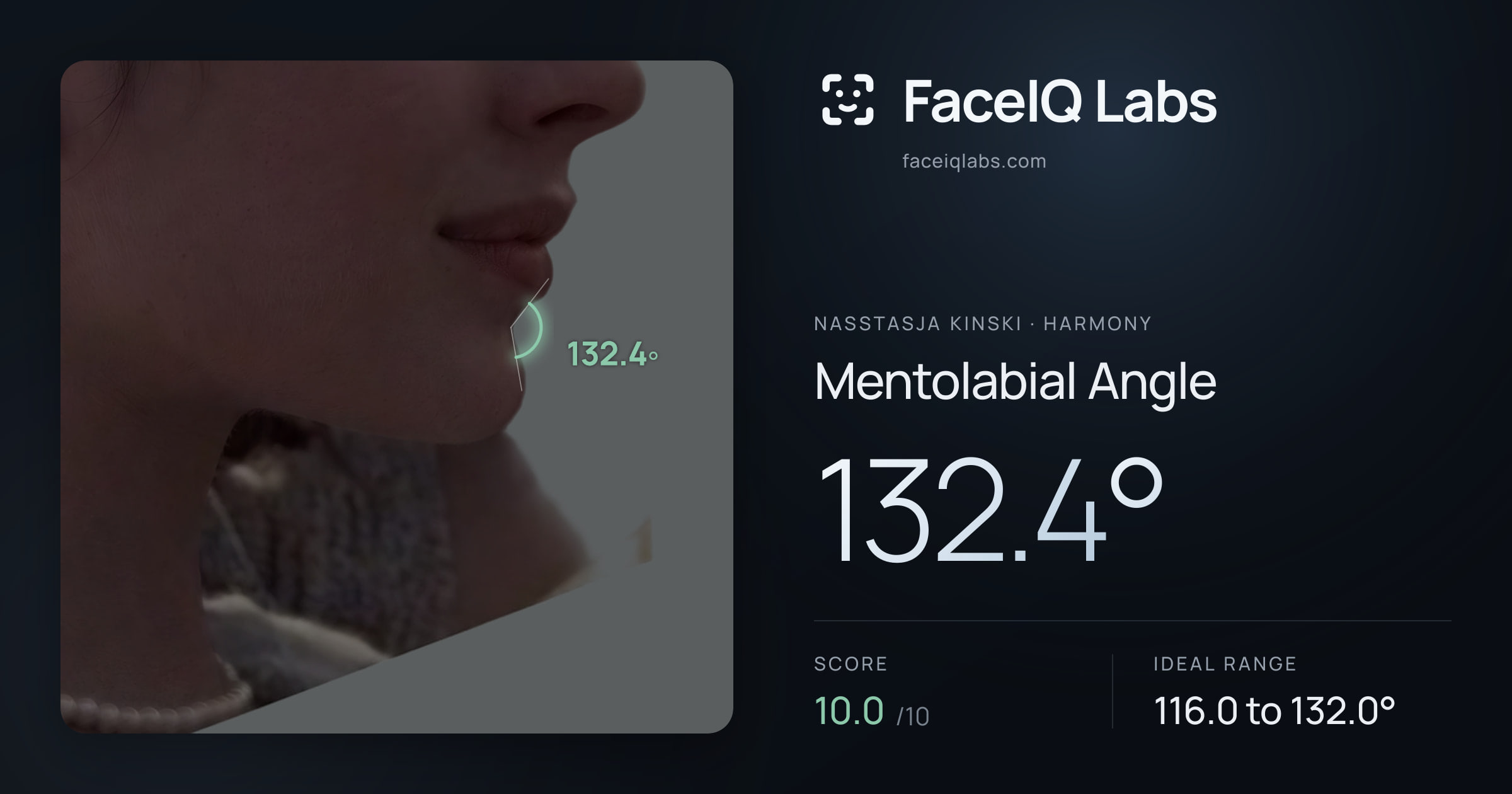 Nasstasja Kinski Mentolabial Angle: 132.4°, drawn on the photo