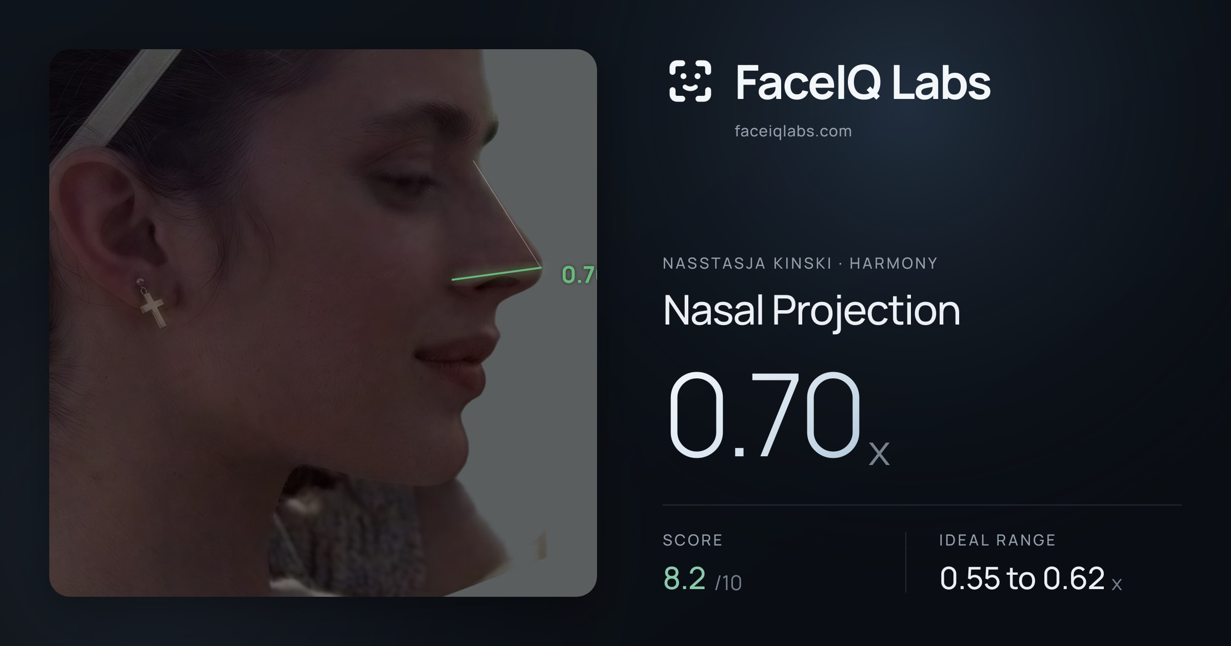 Nasstasja Kinski Nasal Projection: 0.70x, drawn on the photo
