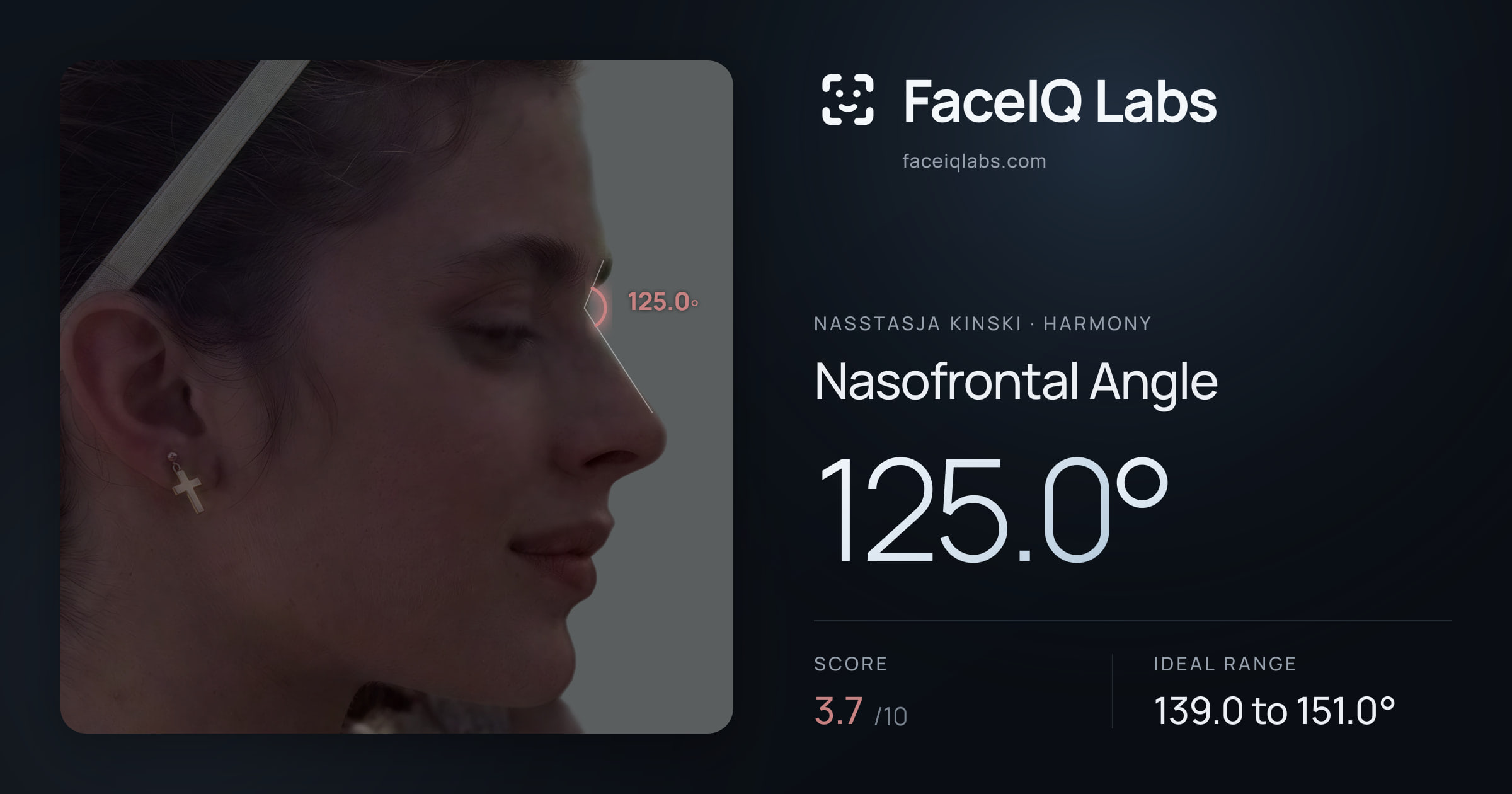 Nasstasja Kinski Nasofrontal Angle: 125.0°, drawn on the photo