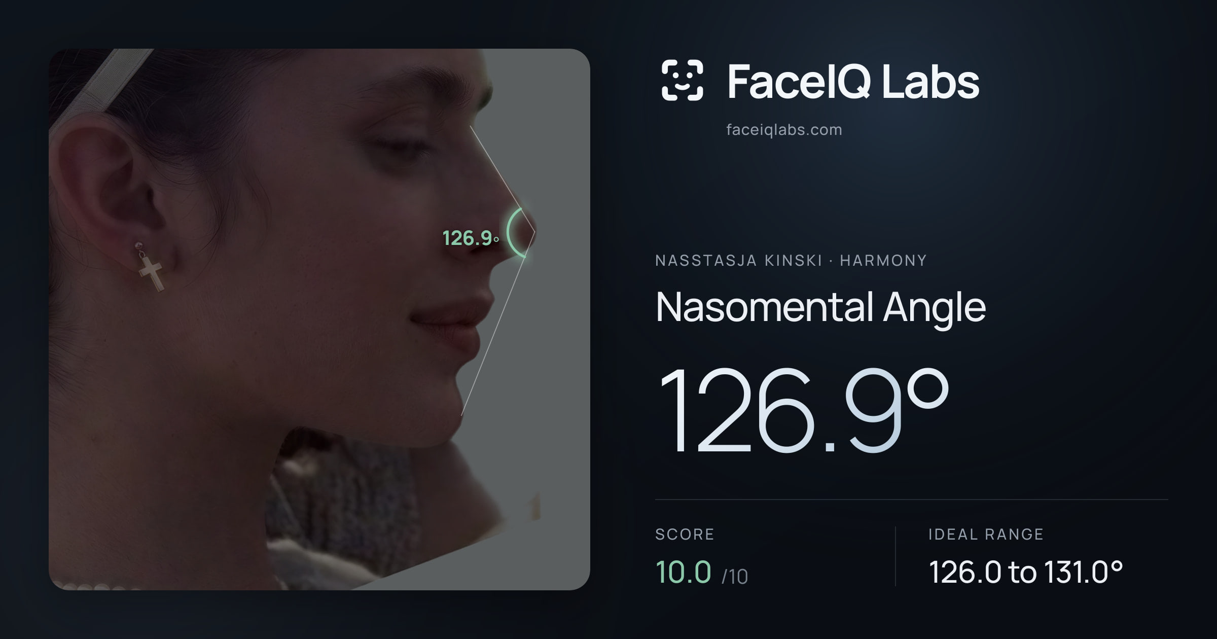 Nasstasja Kinski Nasomental Angle: 126.9°, drawn on the photo