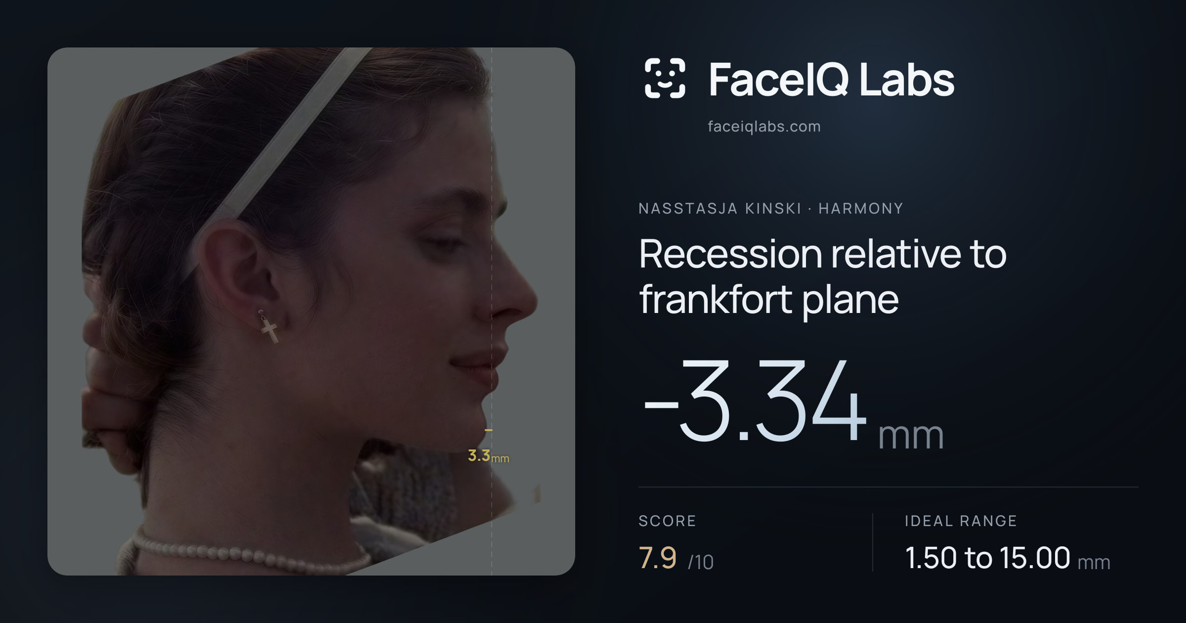 Nasstasja Kinski Recession relative to frankfort plane: -3.34mm, drawn on the photo