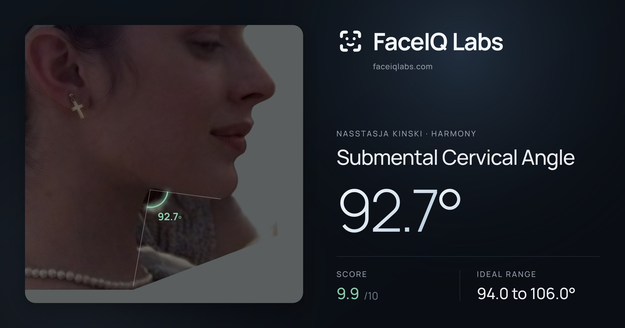 Nasstasja Kinski Submental Cervical Angle: 92.7°, drawn on the photo