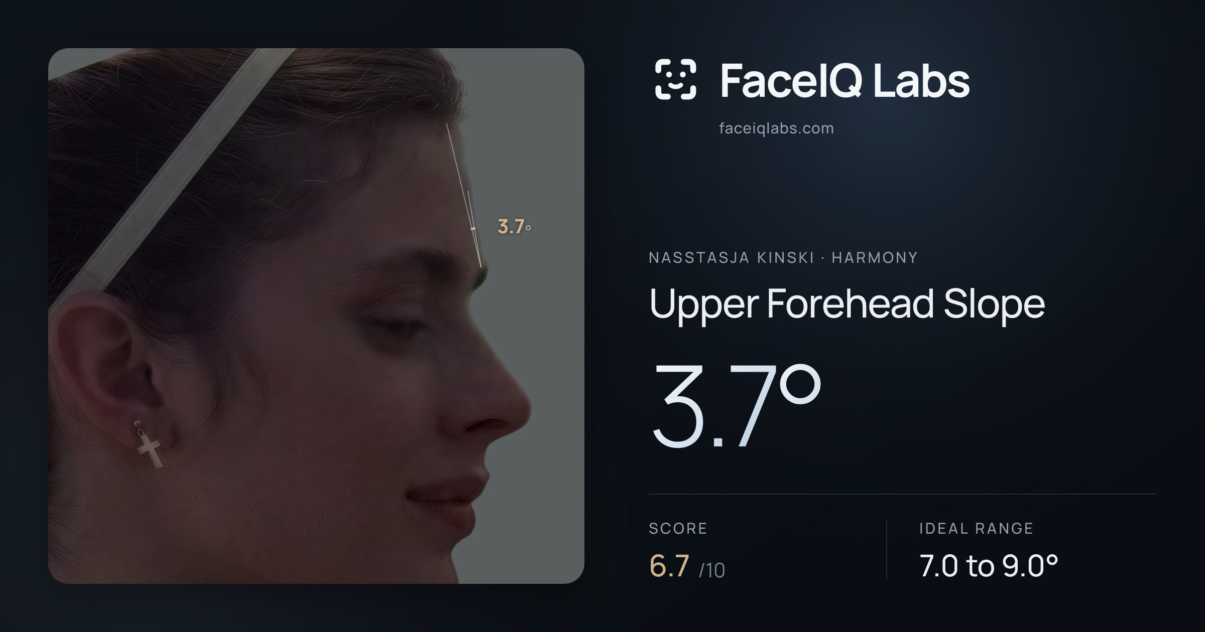 Nasstasja Kinski Upper Forehead Slope: 3.7°, drawn on the photo