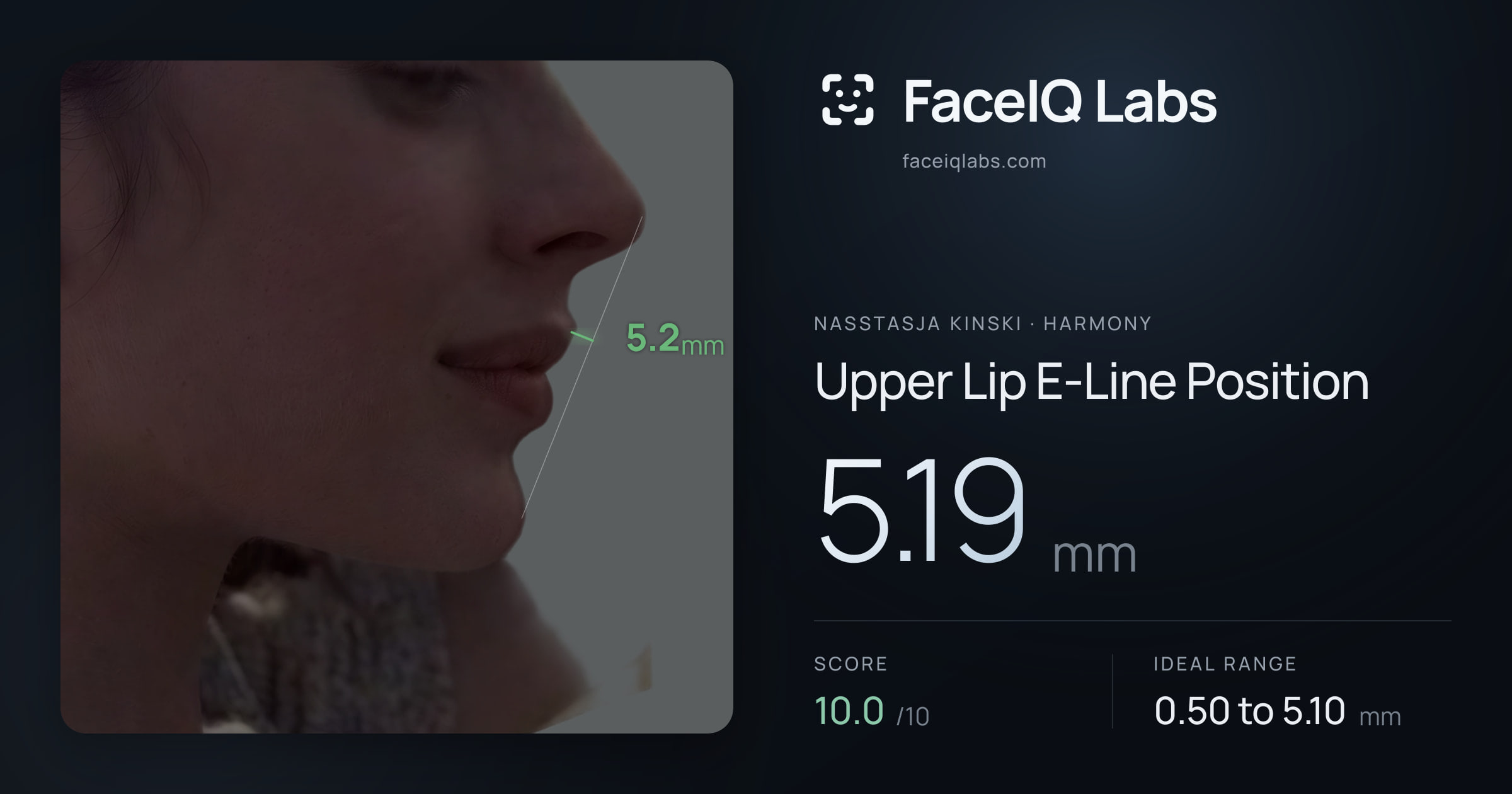 Nasstasja Kinski Upper Lip E-Line Position: 5.19mm, drawn on the photo
