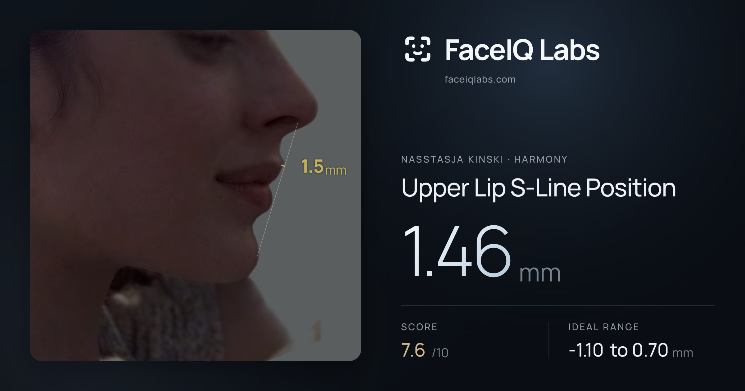 Nasstasja Kinski Upper Lip S-Line Position: 1.46mm, drawn on the photo