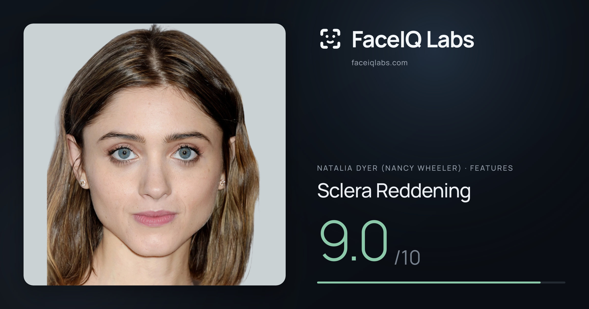 Natalia Dyer (Nancy Wheeler) Sclera Reddening: 9.0/10, drawn on the photo