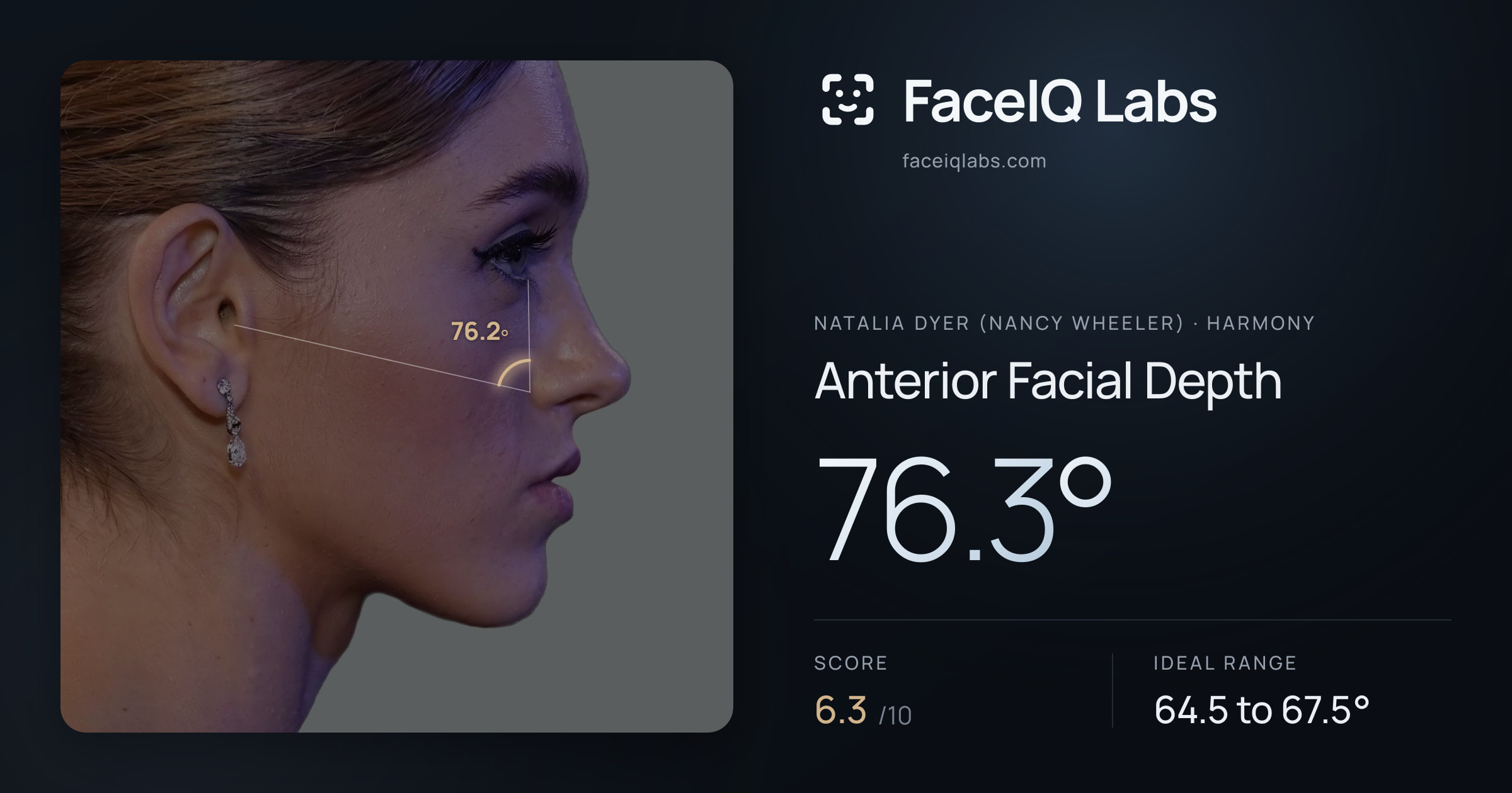 Natalia Dyer (Nancy Wheeler) Anterior Facial Depth: 76.3°, drawn on the photo