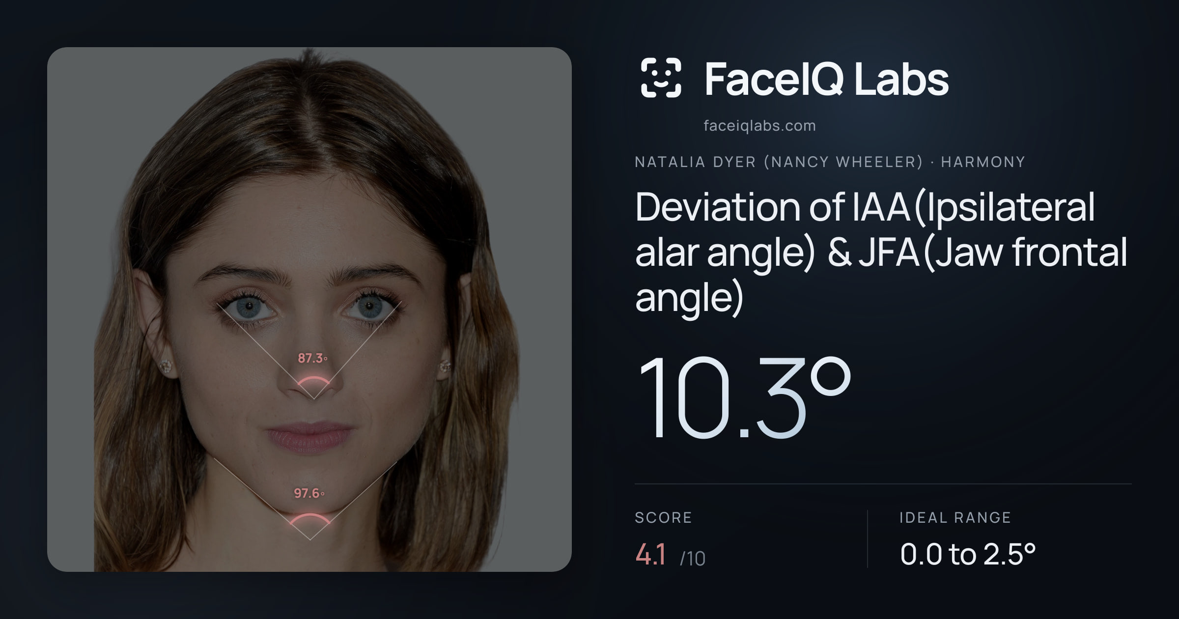 Natalia Dyer (Nancy Wheeler) Deviation of IAA(Ipsilateral alar angle) & JFA(Jaw frontal angle): 10.3°, drawn on the photo