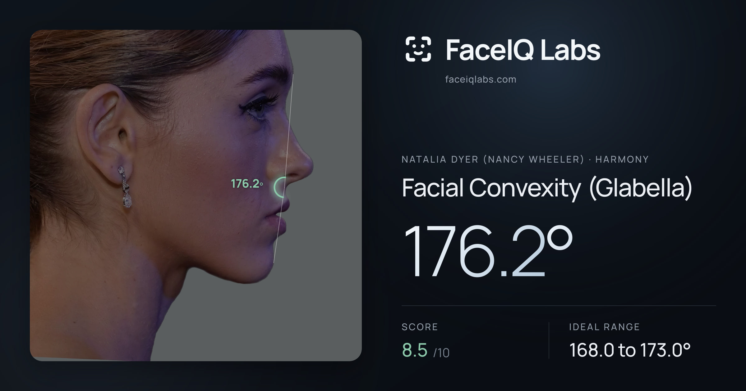 Natalia Dyer (Nancy Wheeler) Facial Convexity (Glabella): 176.2°, drawn on the photo
