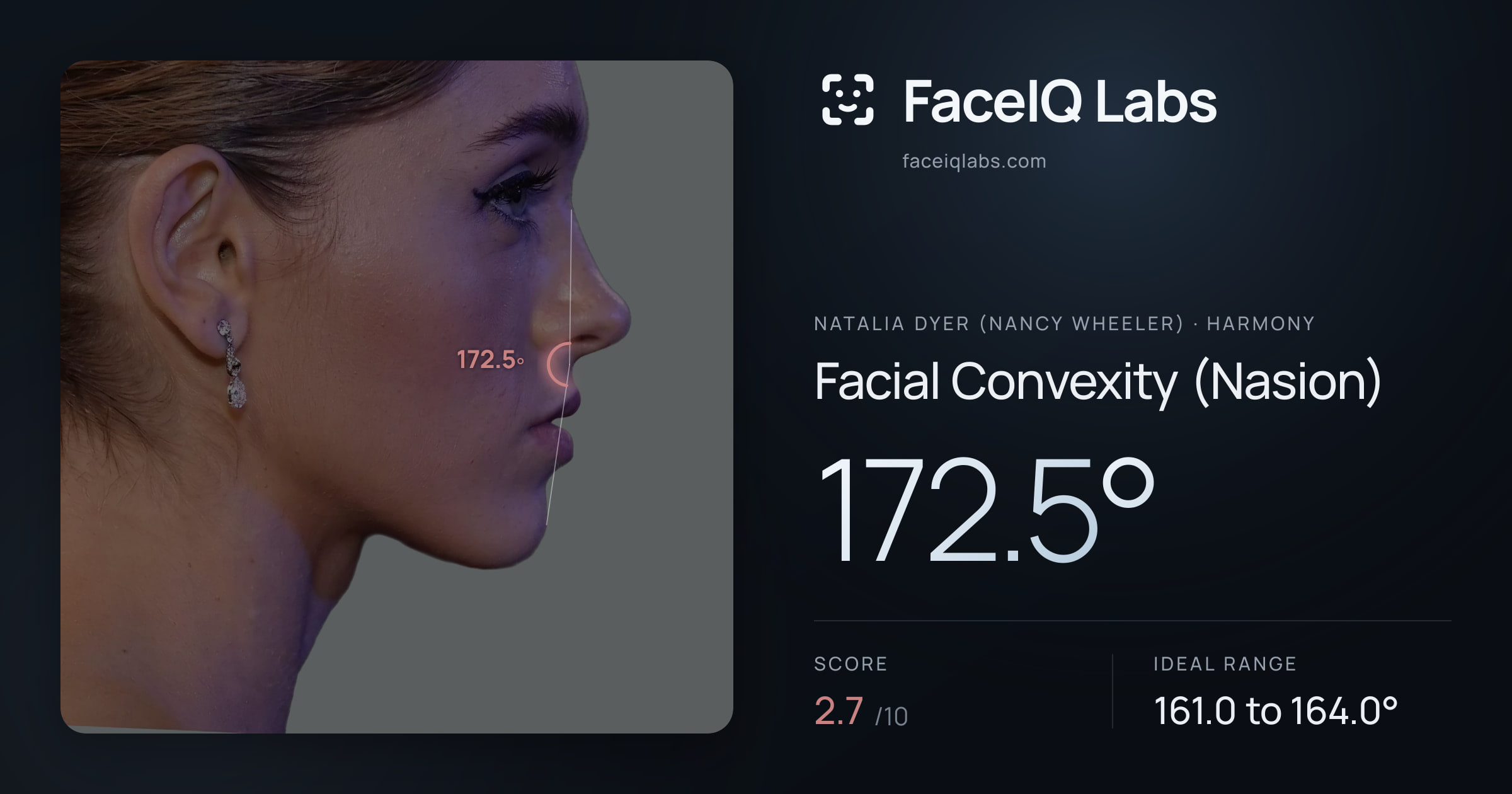 Natalia Dyer (Nancy Wheeler) Facial Convexity (Nasion): 172.5°, drawn on the photo