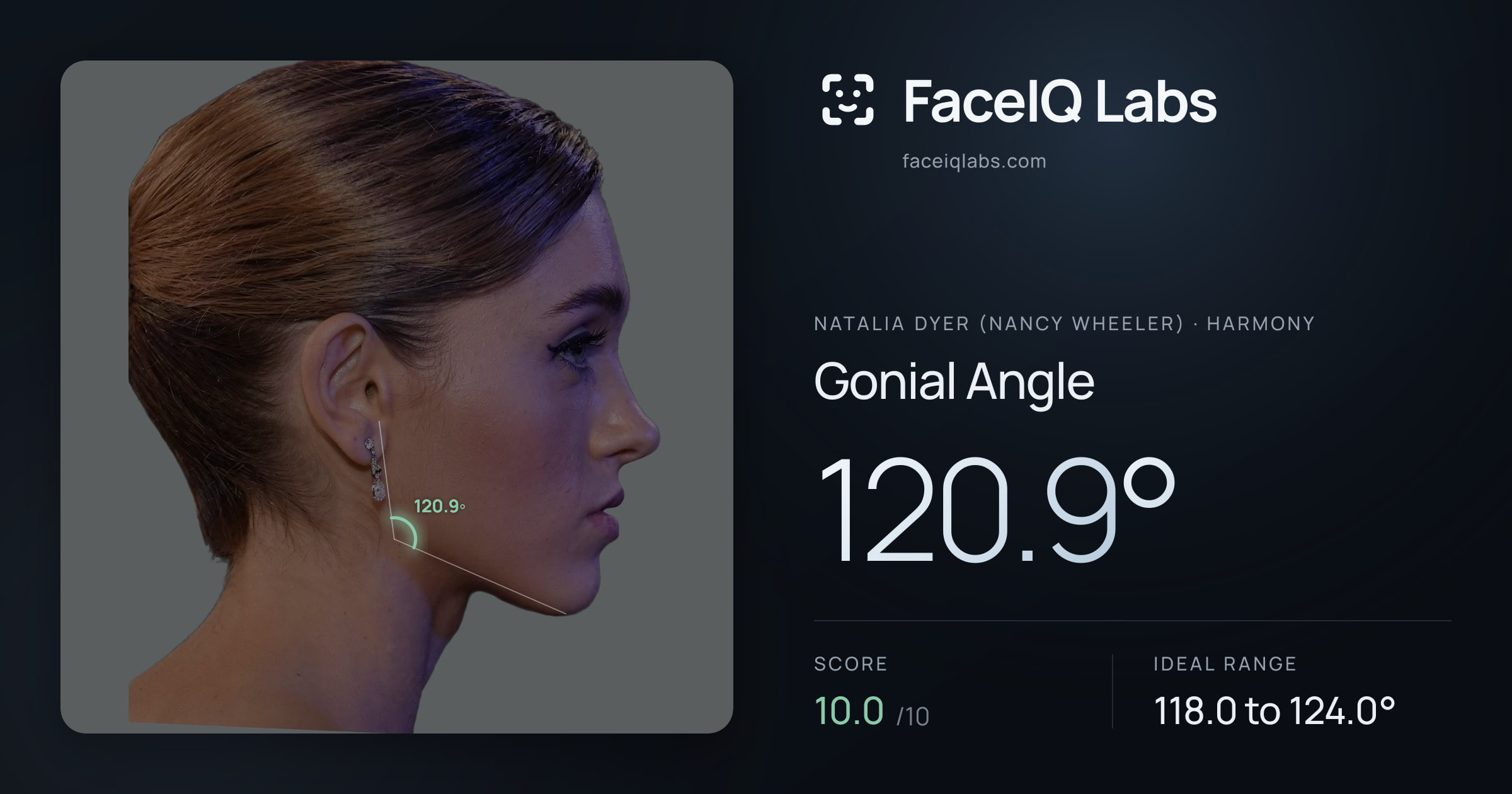 Natalia Dyer (Nancy Wheeler) Gonial Angle: 120.9°, drawn on the photo