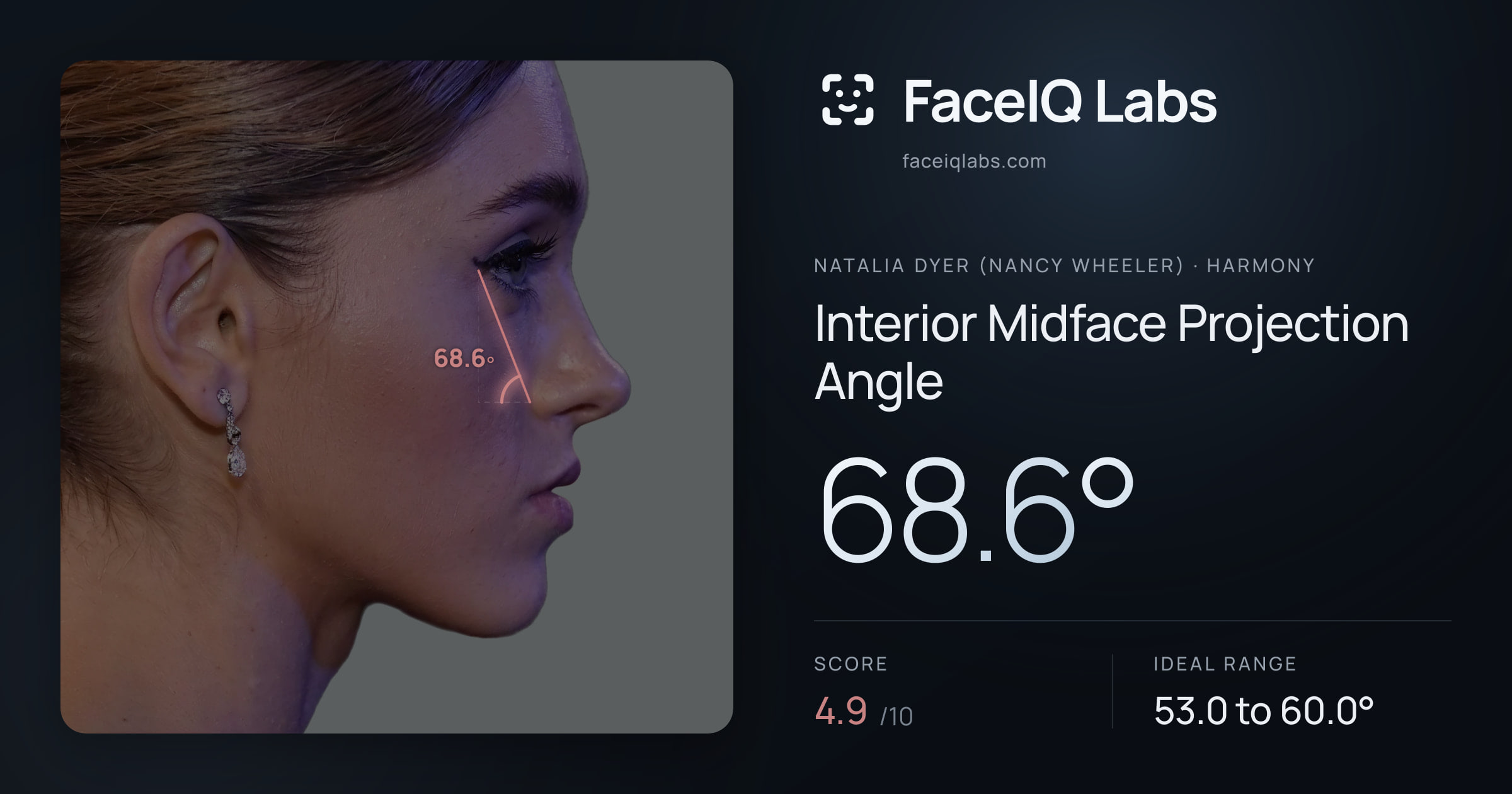 Natalia Dyer (Nancy Wheeler) Interior Midface Projection Angle: 68.6°, drawn on the photo