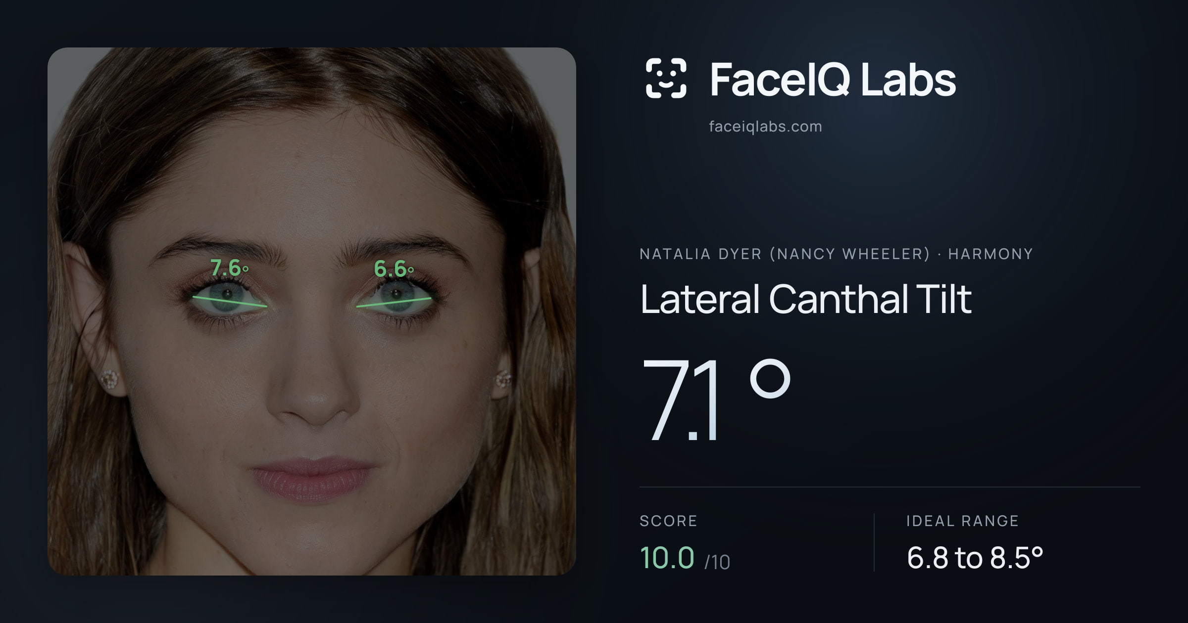 Natalia Dyer (Nancy Wheeler) Lateral Canthal Tilt: 7.1°, drawn on the photo
