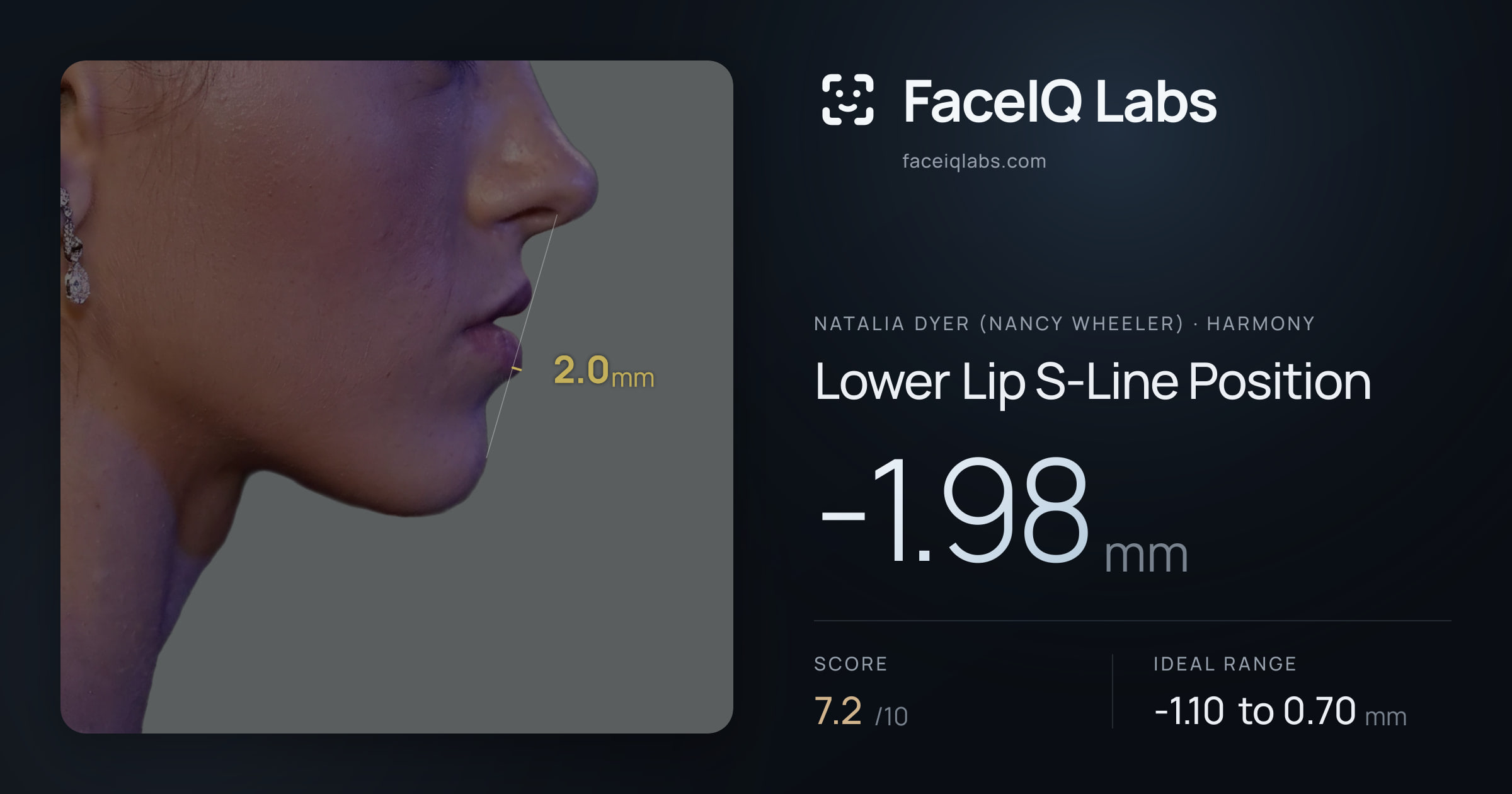 Natalia Dyer (Nancy Wheeler) Lower Lip S-Line Position: -1.98mm, drawn on the photo