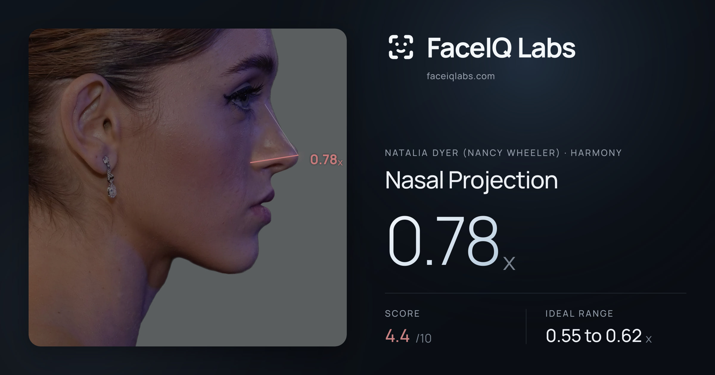 Natalia Dyer (Nancy Wheeler) Nasal Projection: 0.78x, drawn on the photo