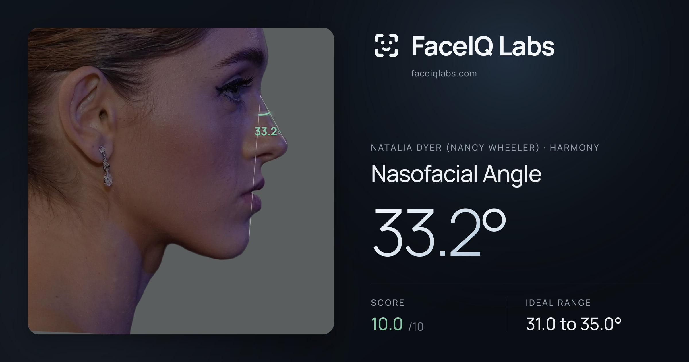 Natalia Dyer (Nancy Wheeler) Nasofacial Angle: 33.2°, drawn on the photo