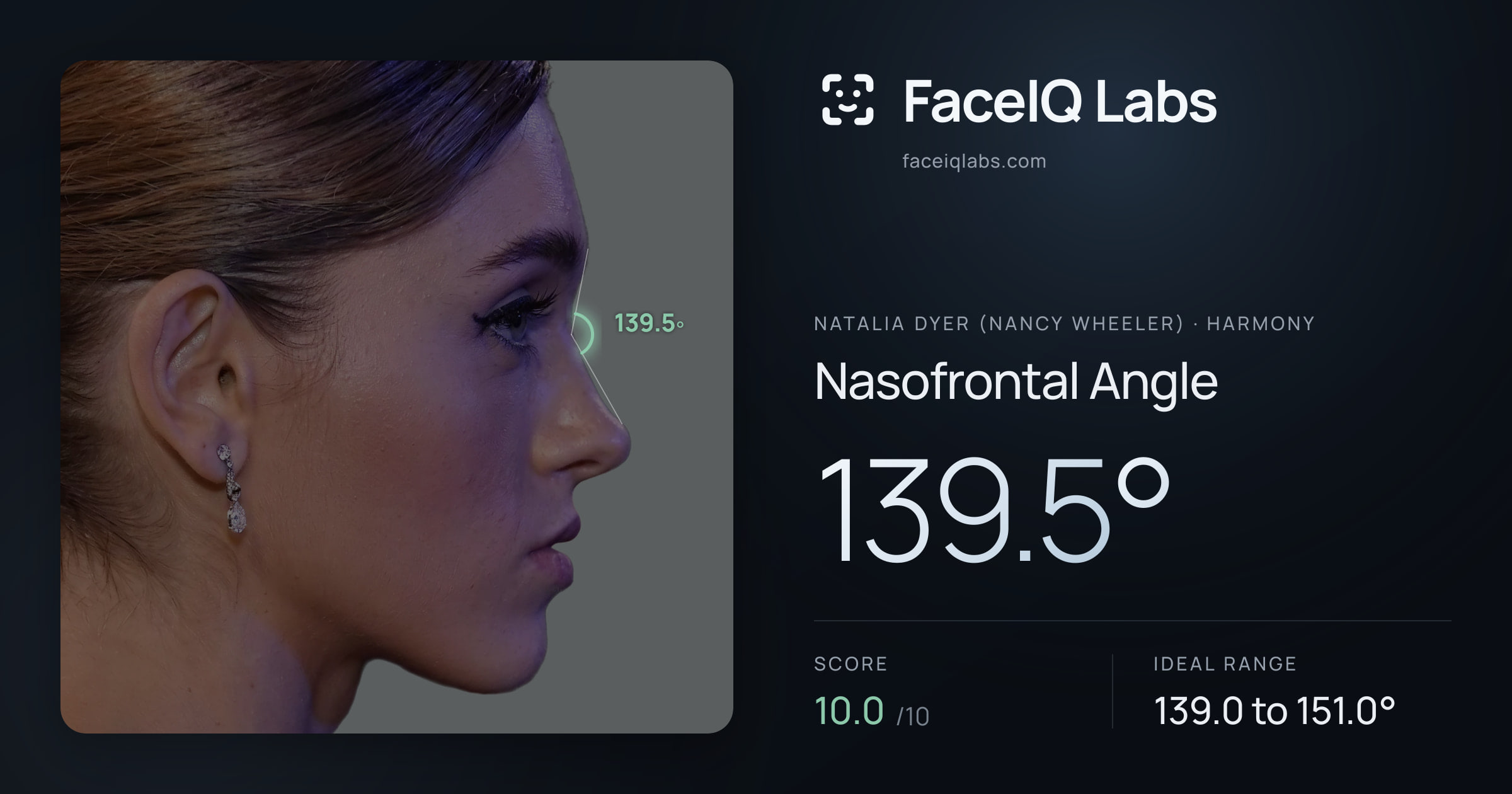 Natalia Dyer (Nancy Wheeler) Nasofrontal Angle: 139.5°, drawn on the photo