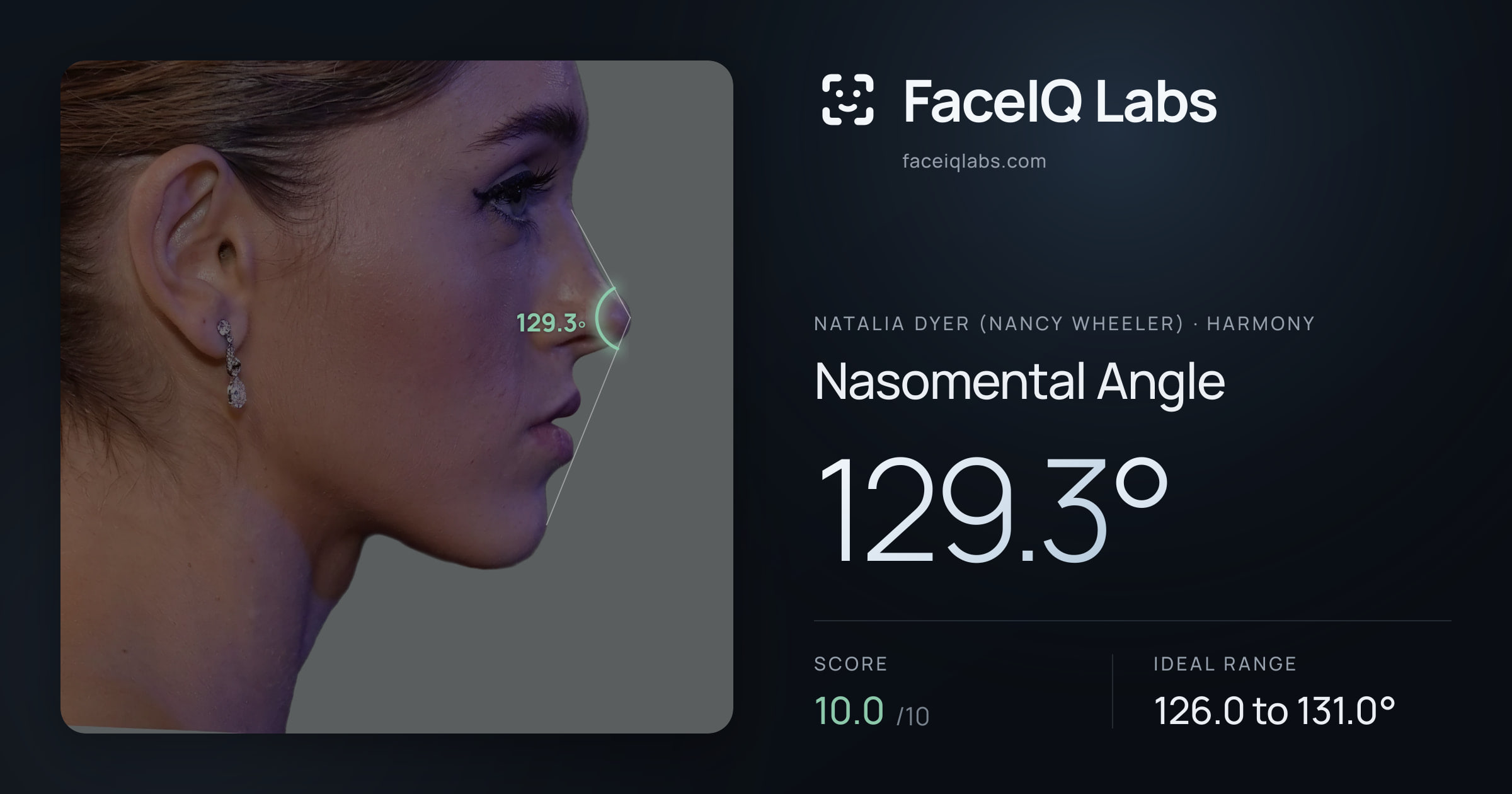 Natalia Dyer (Nancy Wheeler) Nasomental Angle: 129.3°, drawn on the photo
