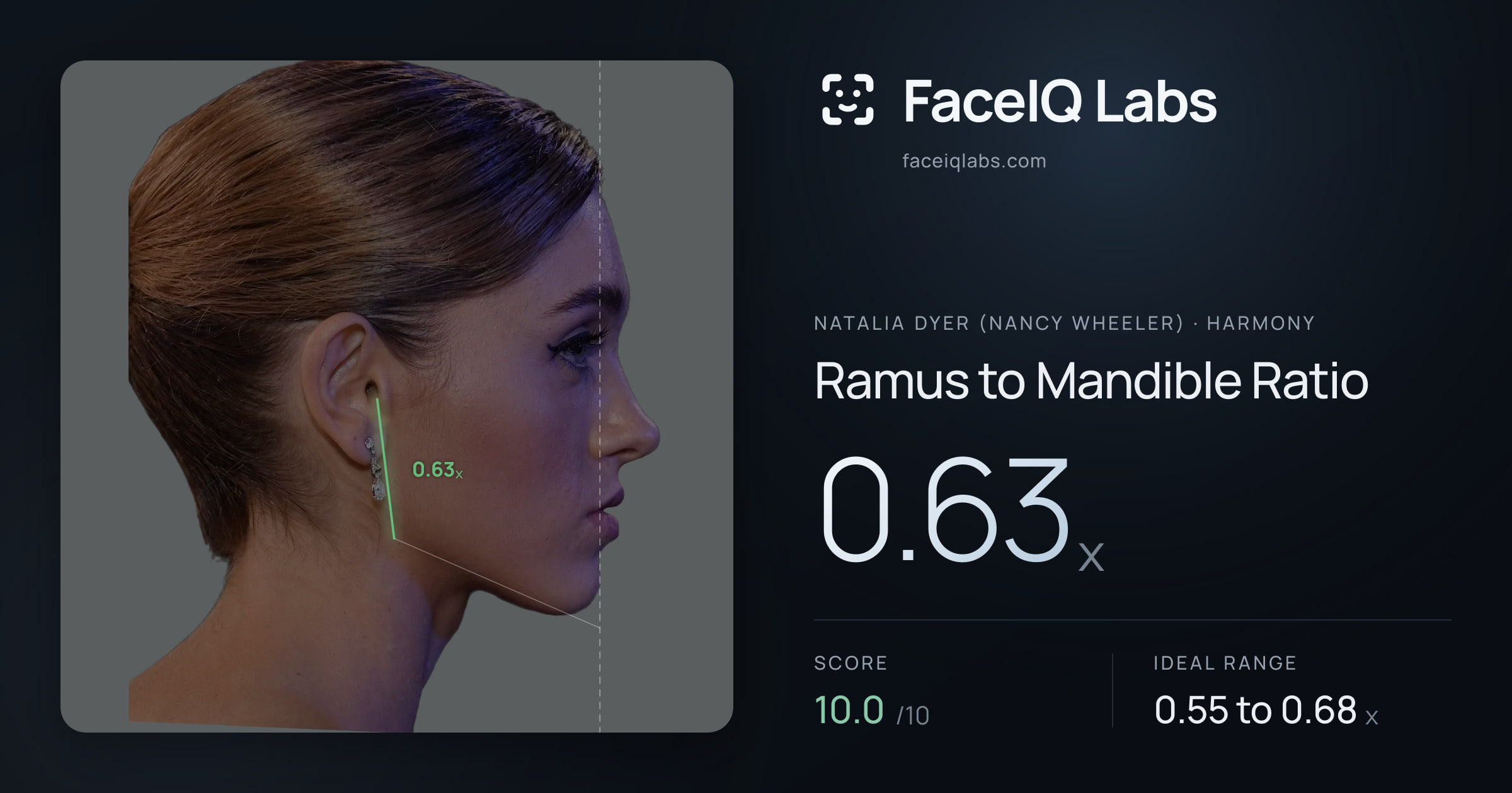 Natalia Dyer (Nancy Wheeler) Ramus to Mandible Ratio: 0.63x, drawn on the photo
