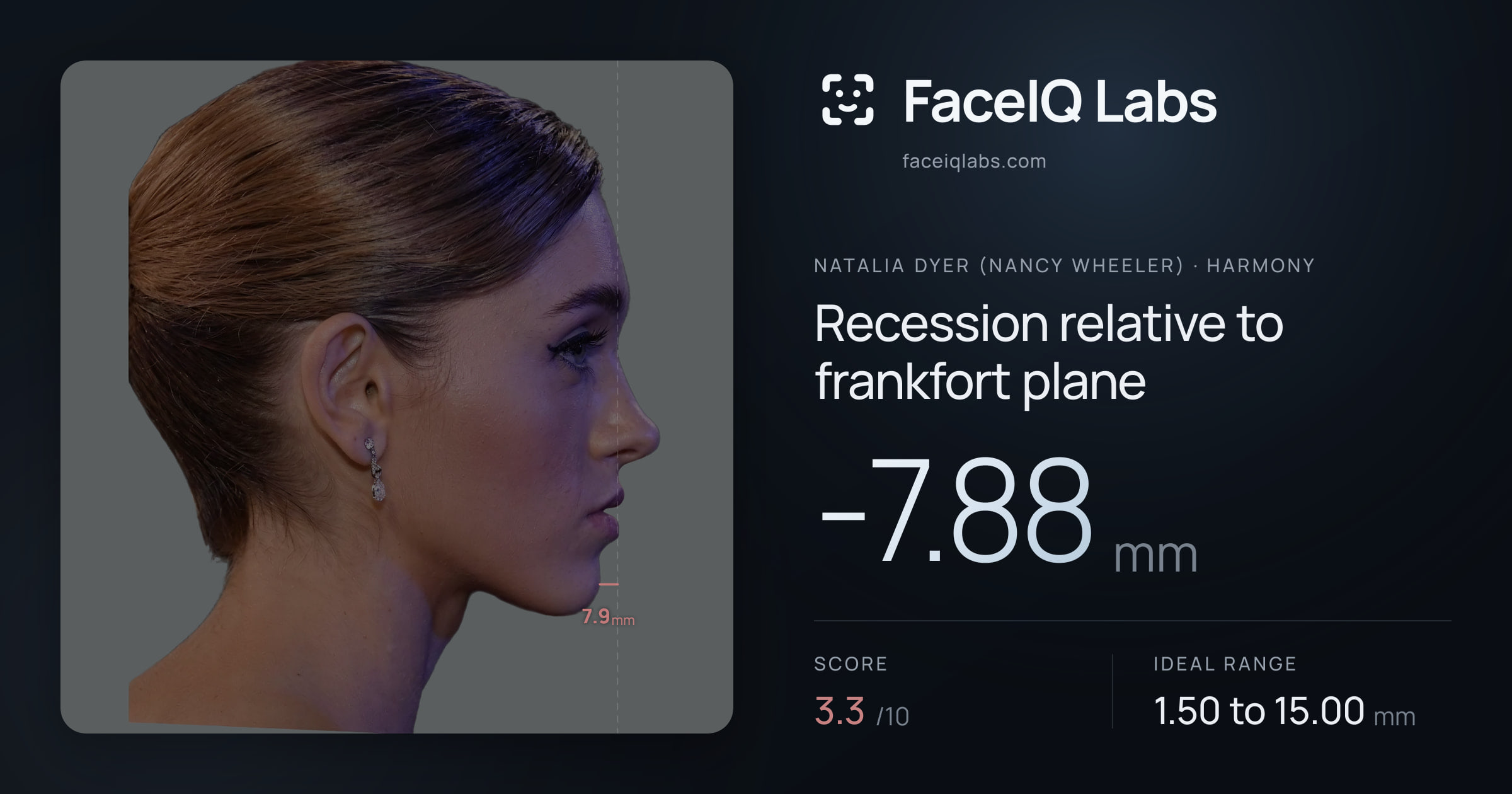 Natalia Dyer (Nancy Wheeler) Recession relative to frankfort plane: -7.88mm, drawn on the photo