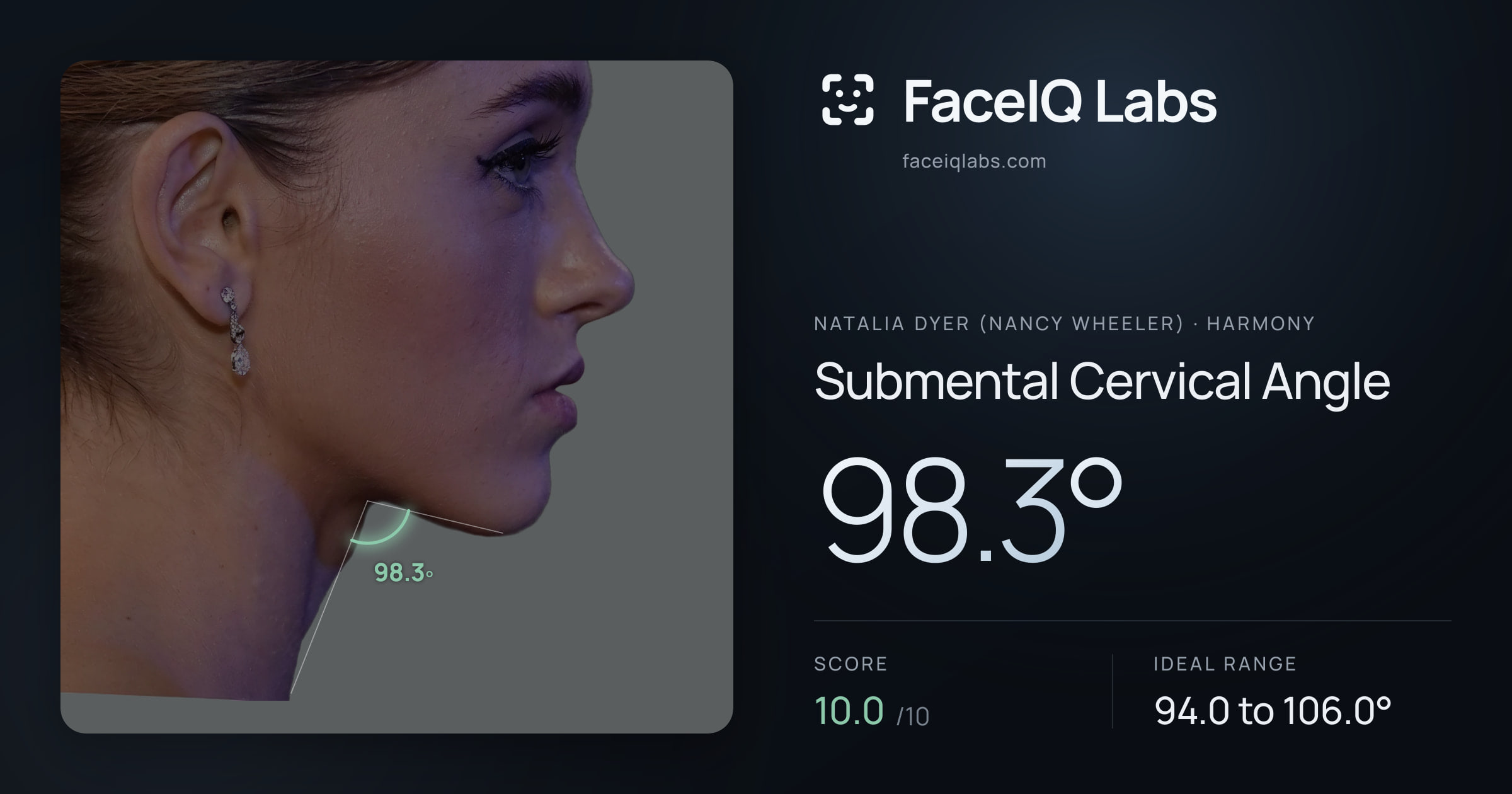 Natalia Dyer (Nancy Wheeler) Submental Cervical Angle: 98.3°, drawn on the photo