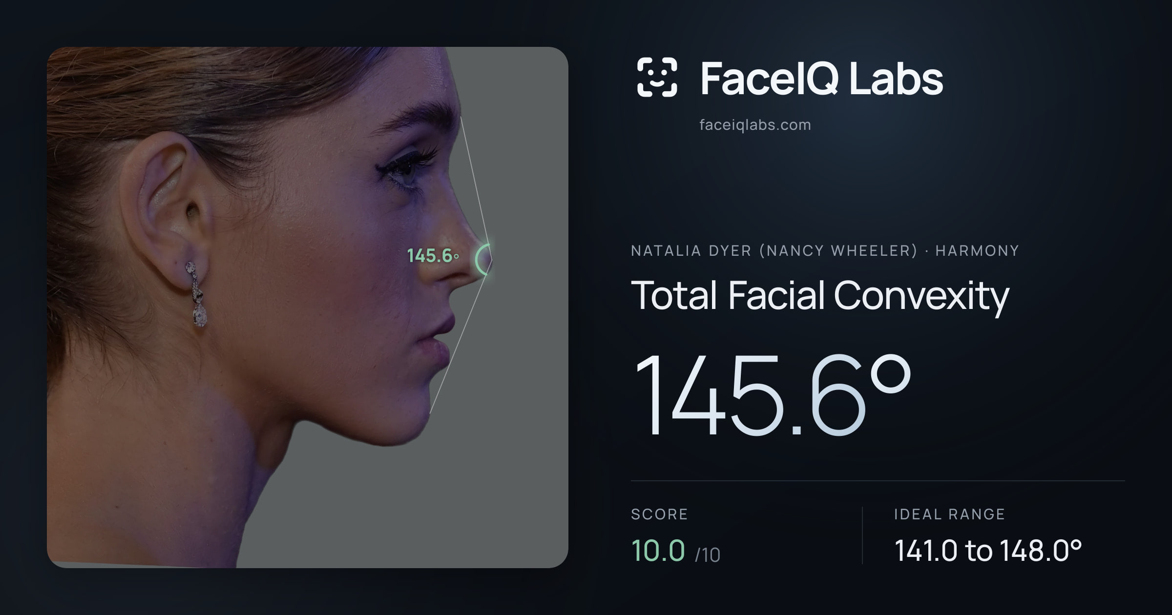Natalia Dyer (Nancy Wheeler) Total Facial Convexity: 145.6°, drawn on the photo